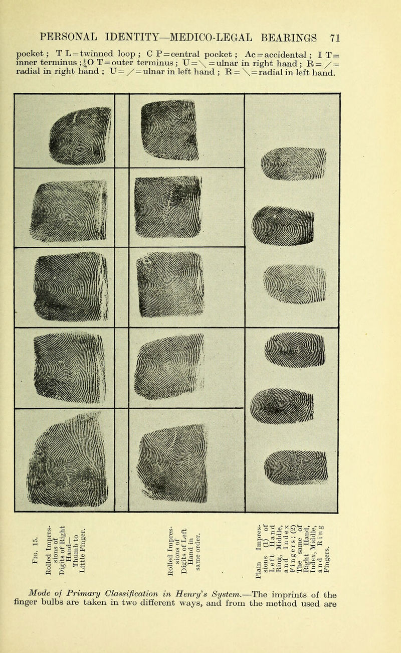 pocket; T L = twinned loop ; C P = central pocket ; Ac - accidental ; I T = inner terminus ;40 T = outer terminus ; U = \ = ulnar in right hand ; Ii= y = radial in right hand ; U= / = ulnar in left hand ; E,= \ = radial in left hand. Mode of Primary Classification in Henry's System.—The imprints of the finger bulbs are taken in two different ways, and from the method used are