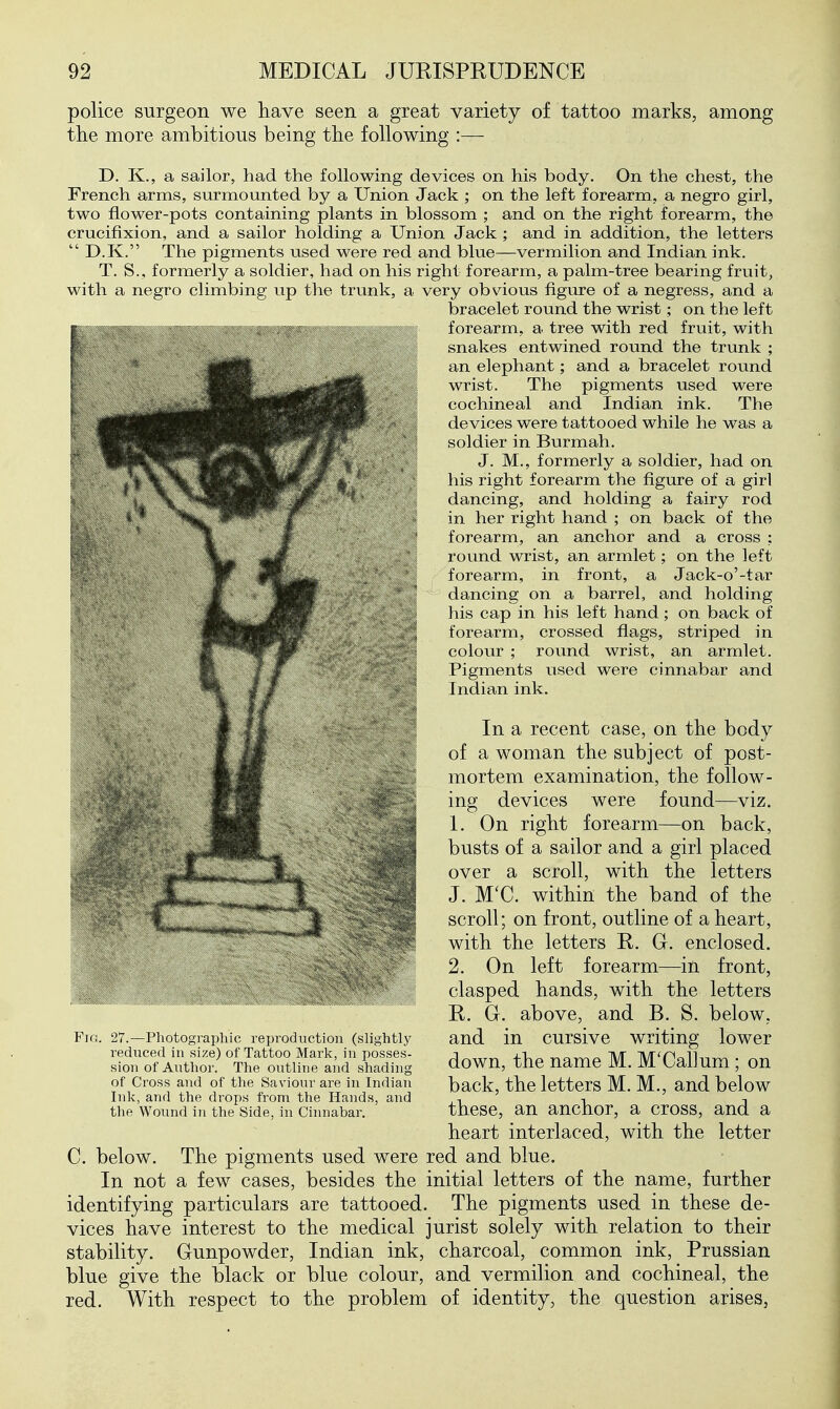 police surgeon we have seen a great variety of tattoo marks, among the more ambitious being the following :— T>. K., a sailor, had the following devices on his body. On the chest, the French arms, surmounted by a Union Jack ; on the left forearm, a negro girl, two flower-pots containing plants in blossom ; and on the right forearm, the crucifixion, and a sailor holding a Union Jack ; and in addition, the letters  D.K. The pigments used were red and blue—vermilion and Indian ink. T. S., formerly a soldier, had on his right forearm, a palm-tree bearing fruit, with a negro climbing up the trunk, a very obvious figure of a negress, and a bracelet round the wrist; on the left forearm, a tree with red fruit, with snakes entwined round the trunk ; an elephant; and a bracelet round wrist. The pigments used were cochineal and Indian ink. The devices were tattooed while he was a soldier in Burmah. J. M., formerly a soldier, had on his right forearm the figure of a girl dancing, and holding a fairy rod in her right hand ; on back of the forearm, an anchor and a cross ; round wrist, an armlet; on the left forearm, in front, a Jack-o'-tar dancing on a barrel, and holding his cap in his left hand; on back of forearm, crossed flags, striped in colour ; round wrist, an armlet. Pigments used were cinnabar and Indian ink. In a recent case, on the body of a woman the subject of post- mortem examination, the follow- ing devices were found—viz. jjjg^ ^ right forearm—on back, ^^mSHL , busts of a sailor and a girl placed over a scroll, with the letters J. M'C. within the band of the scroll; on front, outline of a heart, with the letters R. G. enclosed. 2. On left forearm—in front, clasped hands, with the letters R. G. above, and B. S. below, and in cursive writing lower down, the name M. M'Callum ; on back, the letters M. M., and below these, an anchor, a cross, and a heart interlaced, with the letter C. below. The pigments used were red and blue. In not a few cases, besides the initial letters of the name, further identifying particulars are tattooed. The pigments used in these de- vices have interest to the medical jurist solely with relation to their stability. Gunpowder, Indian ink, charcoal, common ink, Prussian blue give the black or blue colour, and vermilion and cochineal, the red. With respect to the problem of identity, the question arises, Fin. 27.—Pliotogi-aphic reproduction (slightly reduced in size) of Tattoo Mark, in posses- sion of Author. The outline and shading of Cross and of the Saviour are in Indian Ink, and the drops from the Hands, and the Wound in the Side, in Cinnabar.
