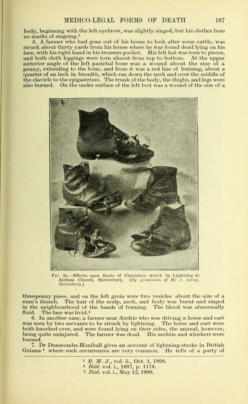 body, beginning with the left eyebrow, was shghtly singed, but his clothes bore no marks of singeing.^ 5. A farmer who had gone out of his house to look after some cattle, was struck about thirty yards from his house where he was found dead lying on his face, with his right hand in his trousers pocket. His felt hat was torn to pieces, and both cloth leggings were torn almost from top to bottom. At the upper anterior angle of the left parietal bone was a wound about the size of a penny, extending to the bone, and from it was a red line of burning, about a quarter of an inch in breadth, which ran down the neck and over the middle of the clavicle to the epigastrium. The trunk of the body, the thighs, and legs were also burned. On the under surface of the left foot was a wound of the size of a Fig. 3t;.—Effects upon Boots of Choristers struck by Lightning at Atcham Church, Shrewsbury. (By permission of Mr J. Lcdng, Shrewsbury.) threepenny piece, and on the left groin were two vesicles about the size of a man's thumb. The hair of the scalp, neck, and body was burnt and singed in the neighbourhood of the bands of burning. The blood was abnormally fluid. The face was livid.^ 6. In another case, a farmer near Airdrie who was driving a horse and cart was seen by two servants to be struck by h'ghtning. The horse and cart were both knocked over, and were found lying on their sides, the animal, however, being quite uninjured. The farmer was dead. His necktie and whiskers were burned. 7. Dr Dunscombe-Honiball gives an account of lightning-stroke in British Guiana ^ where such occurrences are very common. He tells of a party of 1 B. M. J., vol. ii., Oct. 1, 1898. 2 Ihid. vol. i., 1897, p. 1178. 3 Ihid. vol. i.. May 12, 1900.