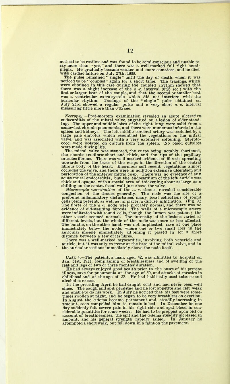 noticed to be restless and was found to be semi-conscious and unable to say more than yes, and there was a well-marked full right hemi- plegia. He gradually became wealser and more comatose, and he died with cardiac failure on July 27th, 1909. The pulse remained  single  until the day of death, when it was noticed to be  coupled  again for a short time. The tracings, which were obtained in this case during the coupled rhythm showed that there was a slight increase of the a.-c. interval (0'25 sec.) with the first or larger beat of the couple, and that the second or smaller beat was a ventricular extra-aystole A'hich did not interfere with the auricular rhythm. Tracings of the single pulse obtained on July 23rd showed a regular pulse and a very short a.-c. interval measuring little more than 0'05 sec. Necropsy.—Post-mortem examination revealed an acute ulcerative endocarditis of the mitral valve, engrafted on a lesion of older stand- ing. The upper and middle lobes of the right lung were solid from a somewhat chronic pneumonia, and there were numerous infarcts in the spleen and kidneys. The left middle cerebral artery was occluded by a large pale embolus which resembled the vegetations on the mitral valve, and was associated with a very extensive softening. Strepto- cocci were isolated on culture from the spleen. No blood cultures were made during life. The mitral valve was stenoaed, the cusps being notably shortened, the chordae tendineae short and thick, and the tips of the papillary muscles fibrous. There was well-marked evidence of fibrosis spreading uowards from the bases of the cusps in the direction of the central fibrous body of the heart. Enormous soft recent vegetations almost occluded the valve, and there were in addition extensive ulceration and perforation of the anterior mitral cusp. There was no evidence of any acute mural endocarditis ; but the endocardium of the left auricle was thick and opaque, with a special area of thickening about as large as a shilling on the contra-foasal wall just above the valve. Microscopic examination of the a.-v. tissues revealed considerable congestion of the tissues generally. The node was the site of a profound Inflammatory disturbance, many focal collections of round cells being present, as well as, in places, a diffuse infiltration. (Fig. 9.) The fibres of the a.-v. node were probably normal, and there was no evidence of old-standing fibrosis. The walls of a microscopic artery were infiltrated with round cells, though the lumen was patent; the other vessels seemed normal. The intensity of the lesions varied at different levels, but the whole of the node was more or less affected. The bundle, on the other hand, was not implicated, save at one place immediately below the node, where one or two small foci in the auricular muscle immediately adjoining it passed in for a short distance between a few of its fibres. There was a well-marked myocarditis, involving both ventricle and auricle, but it was only extreme at the base of the mitral valve, and in the auricular sections immediately above the node itself. Case 4.—The patient, a man, aged 42, was admitted to hospital on Jan. 31st, 1911, complaining of breathlessness and of swelling of the feet and legs of two or three months'duration. He had always enjoyed good health prior to the onset of his present illness, save for pneumonia at the age of 30, and attacks of measles in childhood and at the age of 32. He had habitually used tobacco and alcohol to excess. In the preceding April he had caught cold and had never been well since. The cough and spit persisted and he lost appetite and felt weak and unable to do his work. In July he noticed that his feet were some- times swollen at night, and he began to be very breathless on exertion. In August the oedema became permanent and, steadily increasing in amount, soon compelled him to remain in bed In December he one day suddenly felt severe pain in his right side and spat blood in con- siderable quantities for some weeks. He had to be propped up in bed on account of breathlessness, the spit and the oedema steadily increased in amount, and his general strength rapidly failed. In January he attempted a short walk, but fell down in a faint on the pavement.