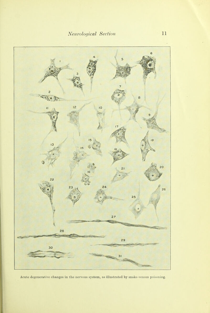 Acute degenerative changes in the nervous system, as illustrated by snake-venom poisoning.