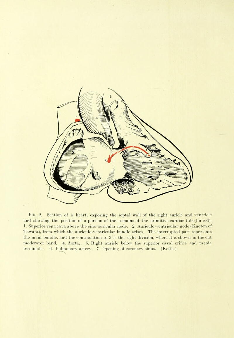 and showing the position of a portion of the remains of the primitive cardiac tube (in red). 1. Superior vena cava above the sino-auricular node. 2. Aiiriculo-ventricular node (Knoten of Tawara), from which the auriculo-ventricular bundle arises. The interrupted part represents the main bundle, and the continuation to 3 is the right division, where it is shown in the cut moderator band. 4. Aorta. 5. Right auricle below the superior caval orifice and taenia terminalis. 6. Pulmonary arterj^ 7. Opening of coronary sinus. (Keith.)