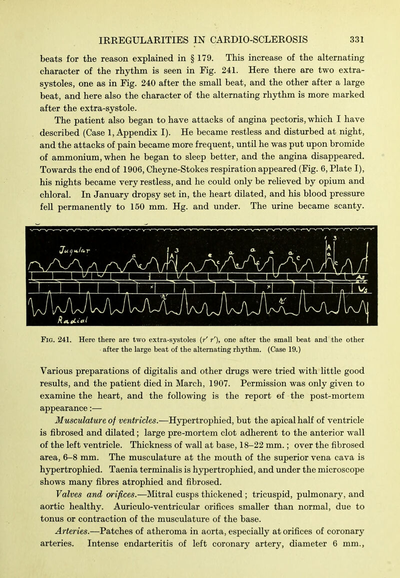 beats for the reason explained in § 179. This increase of the alternating character of the rhythm is seen in Fig. 241. Here there are two extra- systoles, one as in Fig. 240 after the small beat, and the other after a large beat, and here also the character of the alternating rhythm is more marked after the extra-systole. The patient also began to have attacks of angina pectoris, which I have described (Case 1, Appendix I). He became restless and disturbed at night, and the attacks of pain became more frequent, until he was put upon bromide of ammonium, when he began to sleep better, and the angina disappeared. Towards the end of 1906, Cheyne-Stokes respiration appeared (Fig. 6, Plate I), his nights became very restless, and he could only be reHeved by opium and chloral. In January dropsy set in, the heart dilated, and his blood pressure fell permanently to 150 mm. Hg. and under. The urine became scanty. Fig. 241. Here there are two extra-systoles (r' r'), one after the small beat and the other after the large beat of the alternating rhythm. (Case 19.) Various preparations of digitalis and other drugs were tried with little good results, and the patient died in March, 1907. Permission was only given to examine the heart, and the following is the report of the post-mortem appearance:— Musculature of ventricles.—Hypertrophied, but the apical half of ventricle is fibrosed and dilated; large pre-mortem clot adherent to the anterior wall of the left ventricle. Thickness of wall at base, 18-22 mm.; over the fibrosed area, 6-8 mm. The musculature at the mouth of the superior vena cava is hypertrophied. Taenia terminalis is hypertrophied, and under the microscope shows many fibres atrophied and fibrosed. Valves and orifices.—Mitral cusps thickened ; tricuspid, pulmonary, and aortic healthy. Aviriculo-ventricular orifices smaller than normal, due to tonus or contraction of the musculature of the base. Arteries.—Patches of atheroma in aorta, especially at orifices of coronary arteries. Intense endarteritis of left coronary artery, diameter 6 mm.,