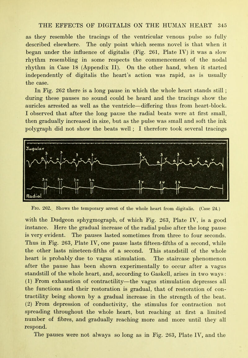 as they resemble the tracings of the ventricular venous pulse so fully described elsewhere. The only point which seems novel is that when it began under the influence of digitalis (Fig. 261, Plate IV) it was a slow rhythm resembling in some respects the commencement of the nodal rhythm in Case 18 (Appendix II). On the other hand, when it started independently of digitalis the heart's action was rapid, as is usually the case. In Fig. 262 there is a long pause in which the whole heart stands still; during these pauses no sound could be heard and the tracings show the auricles arrested as well as the ventricle—differing thus from heart-block. I observed that after the long pause the radial beats were at first small, then gradually increased in size, but as the pulse was small and soft the ink polygraph did not show the beats well; I therefore took several tracings Fig. 262._ Shows the temporary arrest of the whole heart from digitalis. (Case 24.) with the Dudgeon sphygmograph, of which Fig. 263, Plate IV, is a good instance. Here the gradual increase of the radial pulse after the long pause is very evident. The pauses lasted sometimes from three to four seconds. Thus in Fig. 263, Plate IV, one pause lasts fifteen-fifths of a second, while the other lasts nineteen-fifths of a second. This standstill of the whole heart is probably due to vagus stimulation. The staircase phenomenon after the pause has been shown experimentally to occur after a vagus standstill of the whole heart, and, according to Gaskell, arises in two ways : (1) From exhaustion of contractility—the vagus stimulation depresses all the functions and their restoration is gradual, that of restoration of con- tractility being shown by a gradual increase in the strength of the beat. (2) From depression of conductivity, the stimulus for contraction not spreading throughout the whole heart, but reaching at first a limited number of fibres, and gradually reaching more and more until they all respond. The pauses were not always so long as in Fig. 263, Plate IV, and the