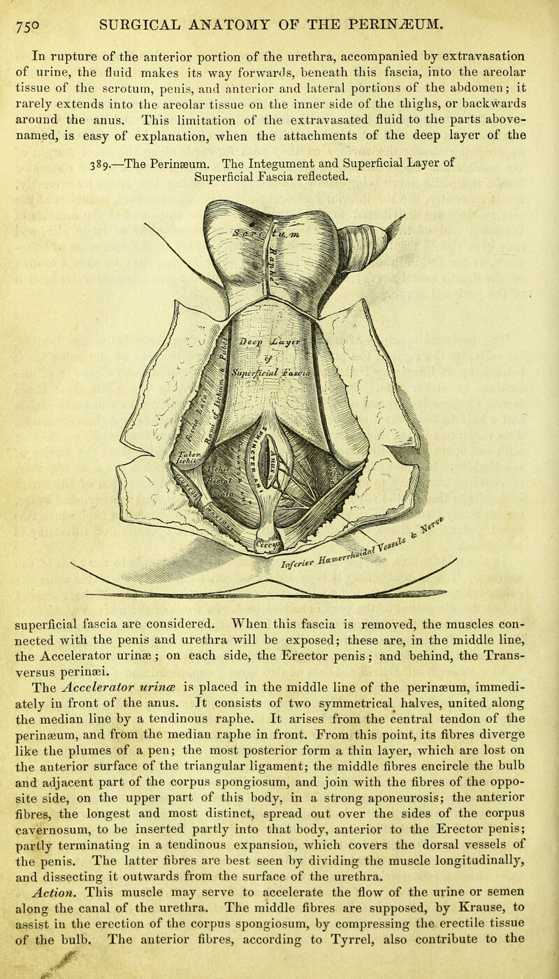 In rupture of the anterior portion of the uretlira, accompanied by extravasation of urine, the fluid maizes its way forwards, beneath this fascia, into the areolar tissue of the scrotum, penis, and anterior and lateral portions of the abdomen; it rarely extends into the areolar tissue ou the inner side of the thighs, or backwards around the anus. This limitation of the extravasated fluid to the parts above- named, is easy of explanation, when the attachments of the deep layer of the 389.—-The Perin£Eum. The Integument and Superficial Layer of Superficial Pascia reflected. superficial fascia are considered. When this fascia is removed, the muscles con- nected with the penis and urethra will be exposed; these are, in the middle line, the Accelerator urinffi; on each side, the Erector penis; and behind, the Trans- versus perinasi. The Accelerator urincB is placed in the middle line of the perinasum, immedi- ately in front of the anus. It consists of two symmetrical halves, united along the median line by a tendinous raphe. It arises from the central tendon of the perineum, and from the median raphe in front. From this point, its fibres diverge like the plumes of a pen; the most posterior form a thin layer, which are lost on the airterior surface of the triangular ligament; the middle fibres encircle the bulb and adjacent part of the corpus spongiosum, and join with the fibres of the oppo- site side, on the upper part of this body, in a strong aponeurosis; the anterior fibres, the longest and most distinct, spread out over the sides of the corpus cavernosum, to be inserted partly into that body, anterior to the Erector penis; partly terminating in a tendinous expansion, which covers the dorsal vessels of the penis. The latter fibres are best seen by dividing the muscle longitudinally, and dissecting it outwards from the surface of the urethra. Action. This muscle may serve to accelerate the flow of the urine or semen along the canal of the urethra. The middle fibres are supposed, by Krause, to assist in the erection of the corpus spongiosum, by compressing the erectile tissue of the bulb. The anterior fibres, according to Tyrrel, also contribute to the