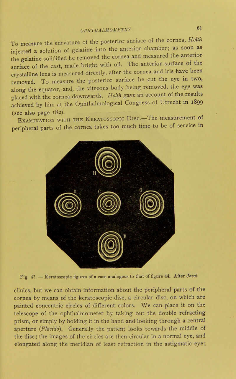 To measure the curvature of the posterior surface of the cornea, Holth injected a solution of gelatine into the anterior chamber; as soon as the gelatine solidified he removed the cornea and measured the anterior surface of the cast, made bright with oil. The anterior surface of the crystalline lens is measured directly, after the cornea and ins have been removed. To measure the posterior surface he cut the eye m two, along the equator, and, the vitreous body being removed, the eye was placed with the cornea downwards. Holth gave an account of the results achieved by him at the Ophthalmological Congress of Utrecht in 1899 (see also page 182). Examination with the Keratoscopic Disc.-^The measurement of peripheral parts of the cornea takes too much time to be of service in Fig. 45. — Keratoscopic figures of a case analogous to that of figure 44. After Javal. clinics, but we can obtain information about the peripheral parts of the cornea by means of the keratoscopic disc, a circular disc, on which are painted concentric circles of different colors. We can place it on the telescope of the ophthalmometer by taking out the double refracting prism, or simply by holding it in the hand and looking through a central aperture (Placido). Generally the patient looks towards the middle of the disc; the images of the circles are then circular in a normal eye, and elongated along the meridian of least refraction in the astigmatic eye;