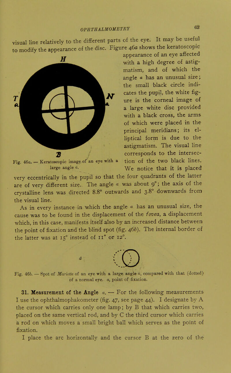 6? visual line relatively to the different parts of the eye. It may be useful to modify the appearance of the disc. Figure 460 shows the keratoscopic ^ appearance of an eye affected with a high degree of astig- matism, and of which the angle a has an unusual size; the small black circle indi- cates the pupil, the white fig- ure is the corneal image of a large white disc provided with a black cross, the arms of which were placed in the principal meridians; its el- liptical form is due to the astigmatism. The visual line corresponds to the intersec- tion of the two black lines. We notice that it is placed very eccentrically in the pupil so that the four quadrants of the latter are of very different size. The angle a was about 9°; the axis of the cr}'stalline lens was directed 8.8° outwards and 3.8° downwards from the visual line. As in every instance in which the angle a has ^n unusual size, the cause was to be found in the displacement of the fovea, a displacement which, in this case, manifests itself also by an increased distance between the point of fixation and the blind spot (fig. 4.6h). The internal border of the latter was at 15° instead of 11° or 12°. Fig. 46a. — Keratoscopic imag^ of an eye with a large angle a. a Fig, 466. — Spot of Mariotte of an eye with a large angle «, compared with that (dotted) of a normal eye. a, point of fixation. 31. Measurement of the Angle a. — For the following measurements I use the ophthalmophakometer (fig. 47, see page 44). I designate by A the cursor which carries only one lamp; by B that which carries two, placed on the same vertical rod, and by C the third cursor which carries a rod on which moves a small bright ball which serves as the point of fixation. I place the arc horizontally and the cursor B at the zero of the