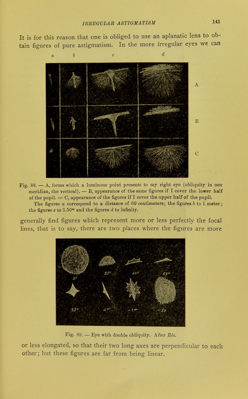 It is for this reason that one is obUged to use an aplanatic lens to ob- tain figures of pure astigmatism. In the more irregular eyes we can a b c d B Fig. 88. — A, forms which a luminous point presents to my right eye (obliciuity in one meridian, the vertical). — B, appearance of the same figures if I cover the lower half of the pupil. — C, appearance of the figures if I cover the upper half of the pupil. The figures a correspond to a distance of 60 centimeters; the figures 6 to 1 meter; the figures c to 1.50 and the figures d to infinity. generally find figures wliich represent more or less perfectly the focal lines, that is to say, there are two places where the figures are more Fig. 89. — Eye with double obliquity. After Ree. or less elongated, so that their two long axes are perpendicular to each other; but these figures are far from being linear.