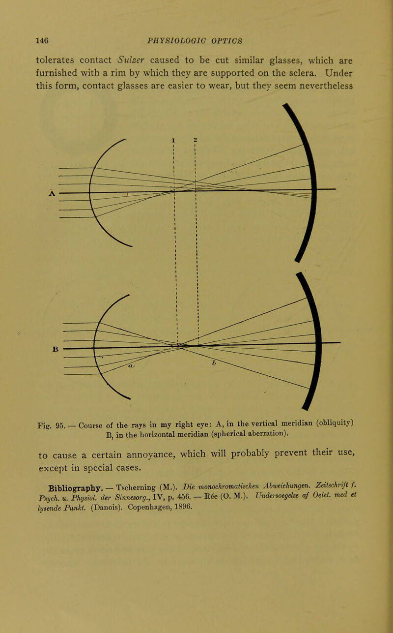 tolerates contact Siiher caused to be cut similar glasses, which are furnished with a rim by which they are supported on the sclera. Under this form, contact glasses are easier to wear, but they seem nevertheless A B Fig. 95. — Course of the rays in my right eye: A, in the vertical meridian (obliquity) B, in the horizontal meridian (spherical aberration). to cause a certain annoyance, which will probably prevent their use, except in special cases. Bibliography. — Tscheming (M.). Die monochromatischen Abweichungen. Zeiischrijt f. Psych, u. Physiol, der Sinnesorg., IV, p. 456. — E6e (O. M.). Undersoegelse of Odd. med ei lysende Punkt. (Danois). Copenhagen, 1896.