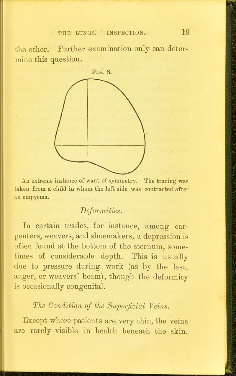 the other. Further examination only can deter- mine this question. Fig. 8. An extreme instance of want of symmetry. The tracing was taken from a child in whom the left side was contracted after an empyema. Deformities. In certain trades, for instance, among car- penters, weavers, and shoemakers, a depression is often found at the bottom of the sternum, some- times of considerable depth. This is usually due to pressure during work (as by the last, auger, or weavers' beam), though the deformity is occasionally congenital. The Condition of the Superficial Veins. Except where patients are very thin, the veins are rarely visible in health beneath the skin.