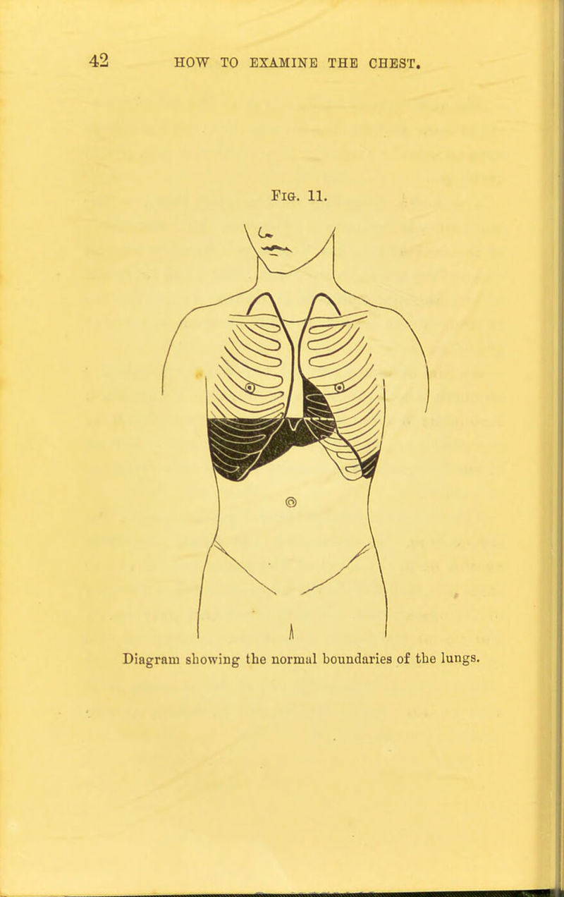 Fig. 11. Diagram showing the normal boundaries of the lungs.