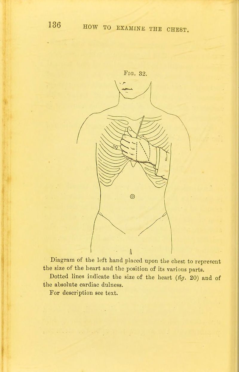 Fig. 32. Diagram of the left hand placed upon the chest to represent the size of the heart and the position of its various parts. Dotted lines indicate the size of the heart (fig. 20) and of the absolute cardiac dulness. For description see text.
