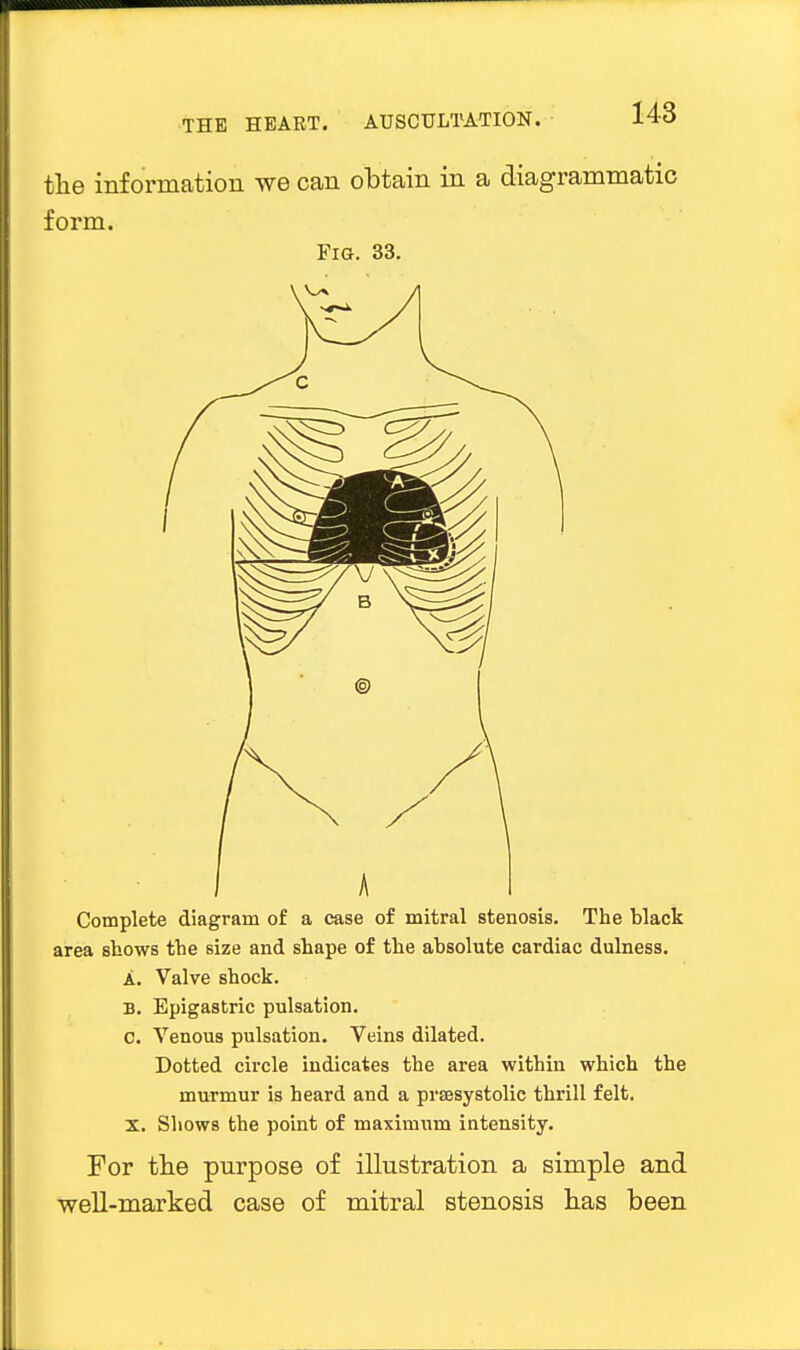 the information we can obtain in a diagrammatic form. Fig. 33. B. 0. Complete diagram of a case of mitral stenosis. The black area shows the size and shape of the absolute cardiac dulness. A. Valve shock. Epigastric pulsation. Venous pulsation. Veins dilated. Dotted circle indicates the area within which the murmur is heard and a presystolic thrill felt. X. Shows the point of maximum intensity. For the purpose of illustration a simple and well-marked case of mitral stenosis has been