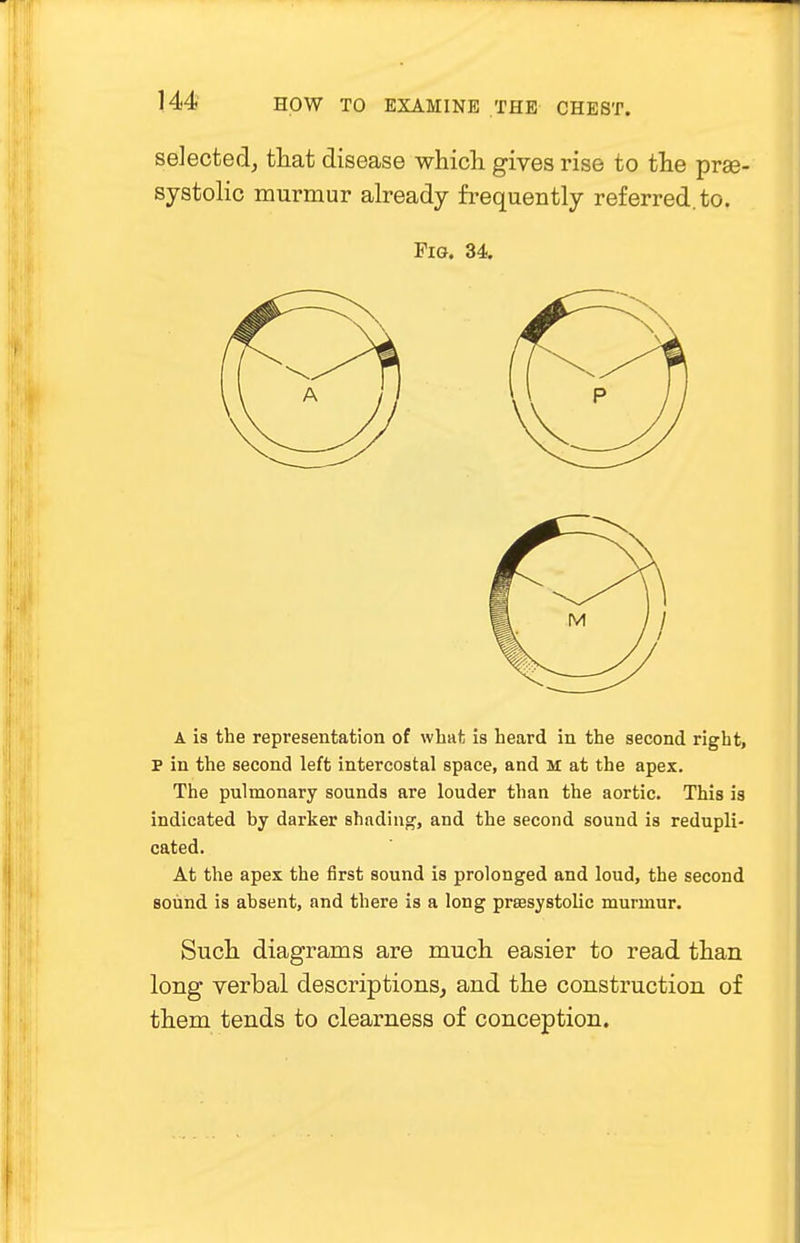 selected, that disease which gives rise to the pre- systolic murmur already frequently referred, to. Fig. 34. A is the representation of what is heard in the second right, P in the second left intercostal space, and M at the apex. The pulmonary sounds are louder than the aortic. This is indicated by darker shading, and the second sound is redupli- cated. At the apex the first sound is prolonged and loud, the second sound is absent, and there is a long presystolic murmur. Such diagrams are much easier to read than long verbal descriptions, and the construction of them tends to clearness of conception.