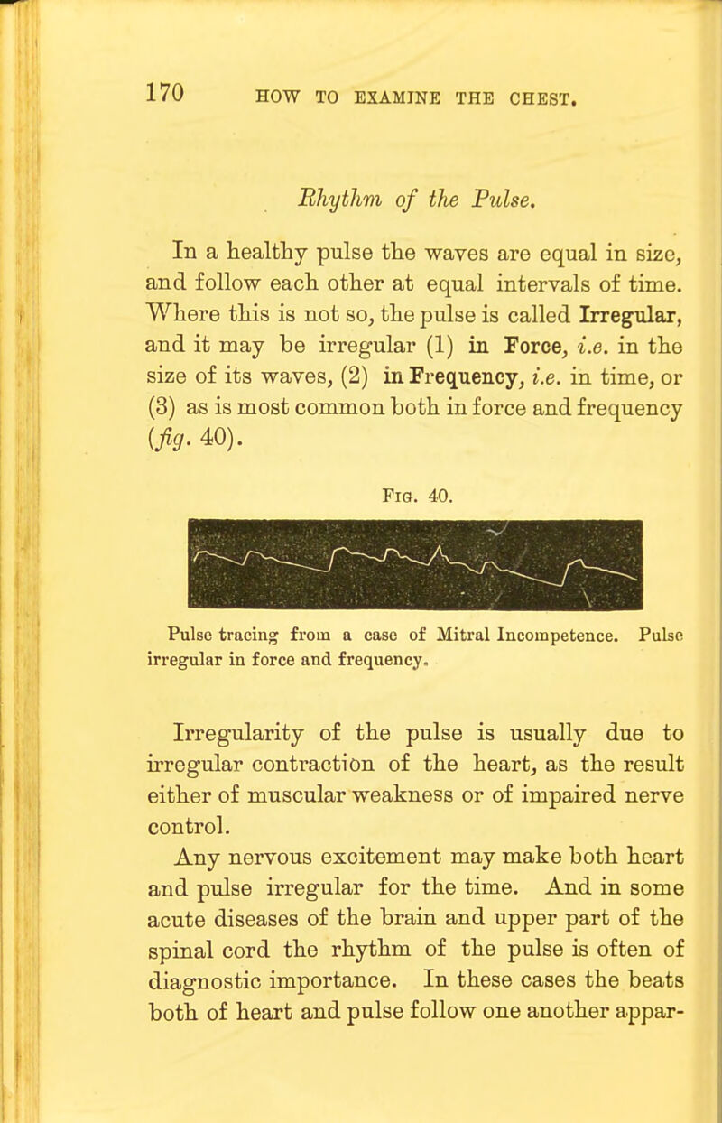 Rhythm of the Pulse. In a healthy pulse the waves are equal in size, and follow each other at equal intervals of time. Where this is not so, the pulse is called Irregular, and it may be irregular (1) in Force, i.e. in the size of its waves, (2) in Frequency, i.e. in time, or (3) as is most common both in force and frequency (fig. 40). Fig. 40. Pulse tracing from a case of Mitral Incompetence. Pulse irregular in force and frequency. Irregularity of the pulse is usually due to irregular contraction of the heart, as the result either of muscular weakness or of impaired nerve control. Any nervous excitement may make both heart and pulse irregular for the time. And in some acute diseases of the brain and upper part of the spinal cord the rhythm of the pulse is often of diagnostic importance. In these cases the beats both of heart and pulse follow one another appar-