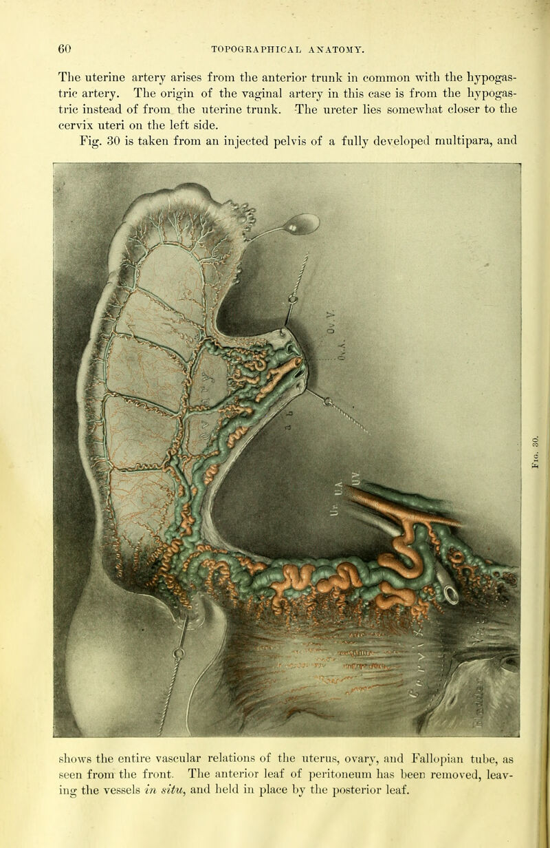 The uterine artery arises from the anterior trunk in common with the hypogas- tric artery. The origin of the vaginal artery in this case is from the hypogas- tric instead of from the uterine trunk. The ureter lies somewhat closer to the cervix uteri on the left side. Fig. 30 is taken from an injected pelvis of a fully developed multipara, and shows the entire vascular relations of the uterus, ovary, and Fallopian tube, as seen from the front. The anterior leaf of peritoneum has been removed, leav- ing the vessels in situ, and held in place by the posterior leaf.