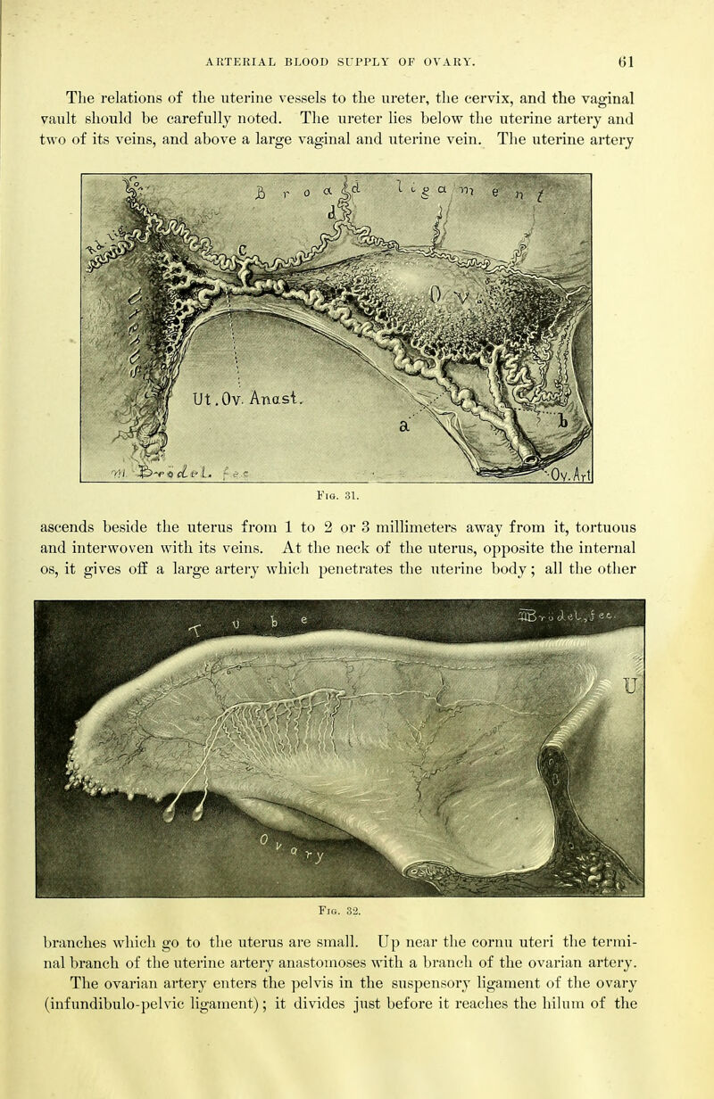 Tlie relations of the iitei'iiie vessels to tlie ureter, the cervix, and the vaginal vault should be carefully noted. The izreter lies below the uterine artery and two of its veins, and above a large vaginal and uterine vein. The uterine artery Fig. 31. ascends beside the uterus from 1 to 2 or 3 millimeters away from it, tortuous and interwoven with its veins. At the neck of the uterus, opposite the internal OS, it gives off a large artery which penetrates the uterine body; all the other Fig. 32. branches which go to the uterus are small. Up near the eornu uteri the termi- nal branch of the uterine artery anastomoses with a branch of the ovarian artery. The ovarian artery enters the pelvis in the suspensory ligament of the ovary (infundibulo-pelvic ligament); it divides just before it reaches the hilum of the