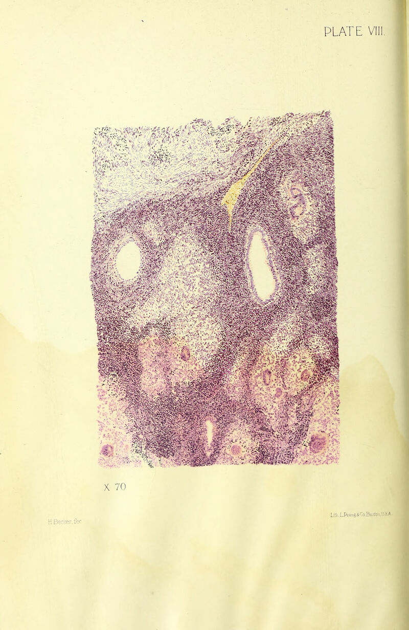 X 70 Li!i-..LPr<m§&Co.Bo.-J HBecker.fer I