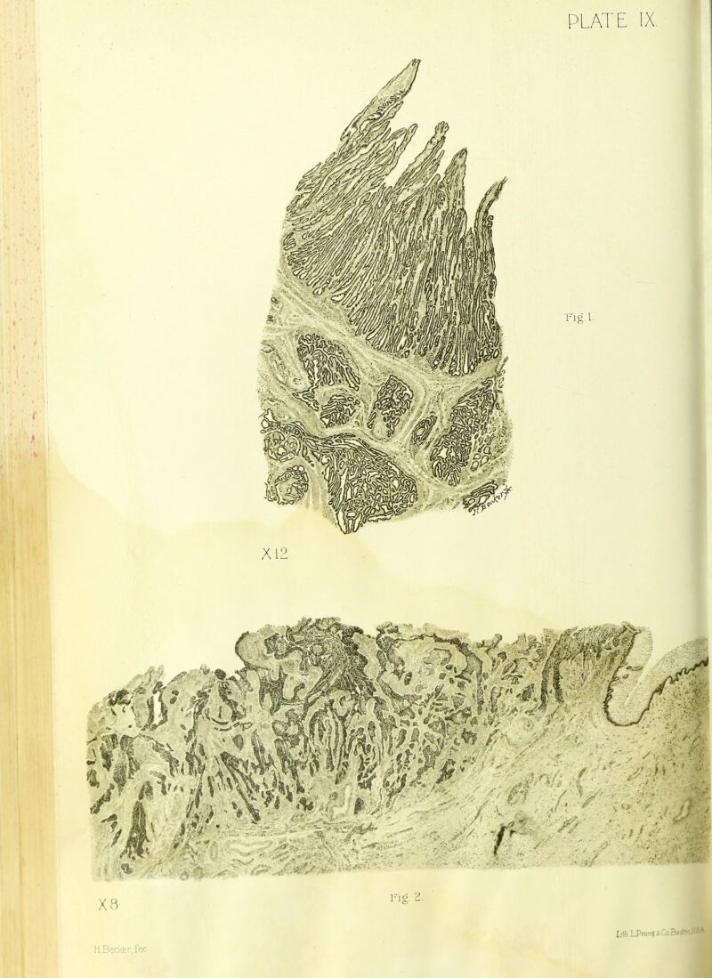 Lifh.LPra«ACo.3o5! H.Becker, fee