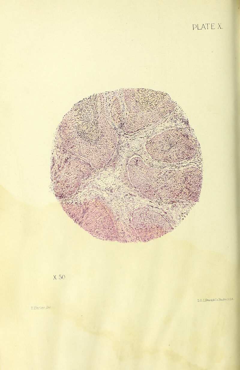 X 50 l.j!l..I.Pran«*CaBostm.ll5.A.