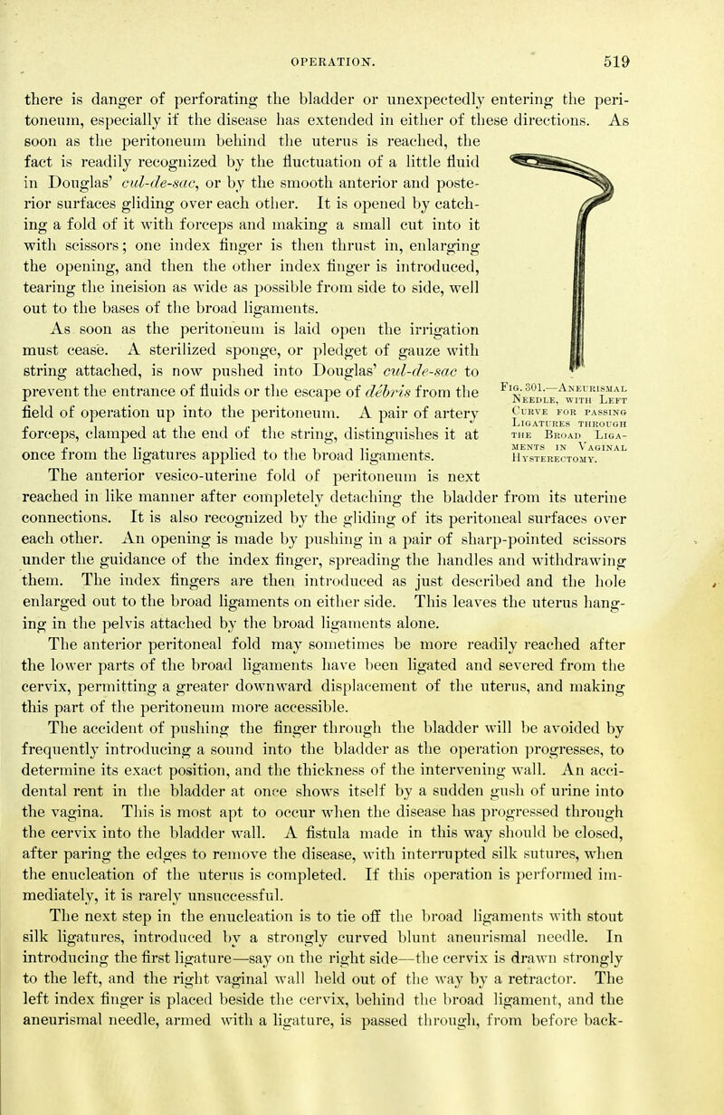 Fig. 301.—Aheurismal Needle, with Left Curve for passino Ligatures through THE Broad Liga- ments IN Vaginal IIystekectomy. there is danger of perforating the bladder or unexpectedly entering the peri- toneum, especially if the disease has extended in either of these directions. As soon as the peritoneum behind the uterus is reached, the fact is readily recognized by the fluctuation of a little fluid in Douglas' cul-de-sac, or by the smooth anterior and poste- rior surfaces gliding over each otlier. It is opened by catch- ing a fold of it with forceps and making a small cut into it with scissors; one index finger is then thrust in, enlarging the opening, and then the other index finger is introduced, tearing the incision as wide as possible from side to side, well out to the bases of the broad ligaments. As soon as the peritoneum is laid open the irrigation must cease. A sterilized sponge, or pledget of gauze with string attached, is now pushed into Douglas' cul-de-sac to prevent the entrance of fluids or the escape of debris from the field of operation up into the peritoneum. A pair of artery forceps, clamped at the end of the string, distinguishes it at once from the ligatures applied to the broad ligaments. The anterior vesico-ixterine fold of peritoneum is next reached in like manner after completely detaching the bladder from its uterine connections. It is also recognized by the gliding of its peritoneal sui'faces over each other. An opening is made by pushing in a pair of sharp-pointed scissors under the guidance of the index finger, spreading the handles and withdrawing them. The index fingers are then inti-oduced as just described and the hole enlarged out to the broad ligaments on either side. This leaves the uterus hang- ing in the pelvis attached by the broad ligaments alone. The anterior peritoneal fold may sometimes be more readily reached after the lower parts of the broad ligaments have been ligated and severed from the cervix, permitting a greater downward displacement of the uterus, and making this part of the peritoneum more accessible. The accident of pushing the finger through the bladder will be avoided by frequently introducing a sound into the bladder as the operation progresses, to determine its exact position, and the thickness of the intervening wall. An acci- dental rent in the bladder at once shows itself by a sudden gush of urine into the vagina. This is most apt to occur when the disease has progressed through the cervix into the bladder wall. A fistula made in this way should be closed, after paring the edges to remove the disease, with inteiTupted silk sutures, when the enucleation of the uterus is completed. If this operation is performed im- mediately, it is rarely unsuccessful. The next step in the enucleation is to tie off the broad ligaments with stout silk ligatures, introduced by a strongly curved blunt aneurismal needle. In introducing the first ligature—say on the right side—the cervix is drawn strongly to the left, and the right vaginal wall held out of the way by a retractor. The left index finger is placed beside the cervix, behind the broad ligament, and the aneurismal needle, armed with a ligature, is passed through, from before back-