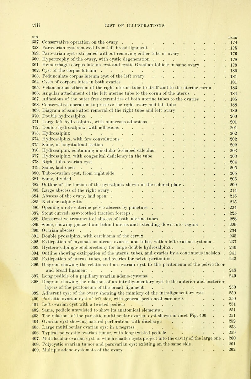 FIG. PAGK 357. Conservative operation on the ovary 174 358. Parovarian cyst removed from left broad ligament . . .175 359. Parovarian cyst extirpated without removing either tube or ovary 176 360. Hypertrophy of the ovary, with cystic degeneration . . . . . . . . 178 361. Hemorrhagic corpus luteum cyst and cystic Graafian follicle in same ovary . . . 179 362. Cyst of the corpus luteum 180 363. Pedunculate corpus luteum cyst of the left ovary 181 364. Cysts of corpora lutea in both ovaries 181 365. Velamentous adhesion of the right uterine tube to itself and to the uterine cornu . . 183 366. Angular attachment of the left uterine tube to the cornu of the uterus .... 184 367. Adhesions of the outer free extremities of both uterine tubes to the ovaries . . . 185 368. Conservative operation to preserve the right ovary and left tube 188 369. Diagram of same after removal of the right tube and left ovary 189 370. Double hydrosalpinx 200 371. Large left hydrosalpinx, with numerous adhesions . . 201 372. Double hydrosalpinx, with adhesions 201 373. Hydrosalpinx 202 374. Hydrosalpinx, with few convolutions 202 375. Same, in longitudinal section 302 376. Hydrosalpinx containing a nodular S-shaped calculus 203 377. Hydrosalpinx, with congenital deficiency in the tube 203 378. Right tubo-ovarian cyst 204 379. Same, laid open 205 380. Tubo-ovarian cyst, from right side 205 381. Same, divided 205 382. Outline of the torsion of the pyosalpinx shown in the colored plate 209 383. Large abscess of the right ovary 214 384. Abscess of the ovarj', laid open 215 385. Nodular salpingitis 215 386. Opening a retro-uterine pelvic abscess by puncture 224 387. Stout curved, saw-tootlied traction forceps 225 388. Conservative treatment of abscess of both uterine tubes ....... 228 389. Same, showing gauze drain behind uterus and extending down into vagina . . . 229 390. Ovarian abscess 234 391. Double pyosalpinx, with careinouia of the cervix 235 392. Extirpation of myomatous uterus, ovaries, and tubes, with a left ovarian cystoma . . 237 393. Ilystero-salpingo-oophoreetomy for large double hydrosalpinx 240 394. Outline showing extirpation of the uterus, tubes, and ovaries by a continuous incision . 241 395. Extirpation of uterus, tubes, and ovaries for pelvic peritonitis 243 396. Diagram showing the relations of an ovarian cyst to the peritoneum of the pelvic floor and broad ligament 248 397. Long pedicle of a papillary ovarian adeno-cystoma 249 398. Diagram showing the relations of an intraligamentary cyst to the anterior and posterior layers of the peritoneum of the broad ligament 250 399. Adherent cyst of the ovary showing the mimicry of the intraligamentary cyst . . 250 400. Parasitic ovarian cyst of left side, with general peritoneal carcinosis .... 250 401. Left ovarian cyst with a twisted pedicle 251 402. Same, pedicle untwisted to show its anatomical elements 251 403. The relations of the parasitic niultilocular ovarian cyst shown in inset Fig. 400 . . 251 404. Ovarian cyst showing natural perforation, with discharge 252 405. Large niultilocular ovarian cyst in a negress ......... 253 406. Typical polycystic ovarian tumor, with long twisted pedicle ....... 259 407. Multilocular ovarian cyst, in which smaller cysts project into the cavity of the large one . 260 408. Polycystic ovarinn tumor and parovarian cyst existing on the same side .... 261 409. Multiple adeno-cystomata of the ovary 262