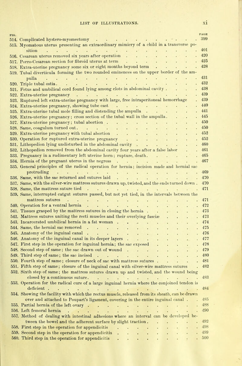 FIG. PAS 514. Complicated hystero-myomectomy . 399 515. Myomatous uterus presenting an extraordinary mimicry of a child in a transverse po- sition 401 516. Cesarean uterus removed six years after operation 420 517. Porro-Cesarean section for fibroid uterus at term 425 518. Extra-ulerine pregnancy some six or eight months beyond term 428 519. Tubal diverticula forming the two rounded eminences on the upper border of the am- pulla 431 520. Triple tubal ostia 432 521. Fetus and umbilical cord found lying among clots in abdominal cavity .... 438 522. Extra-uterine pregnancy 439 523. Ruptured left extra-uterine pregnancy with large, free intraperitoneal hemorrhage . 439 524. Extra-uterine pregnancy, showing tube cast 440 525. Extra-uterine tubal mole filling and distending the ampulla 441 526. Extra-uterine pregnancy ; cross section of the tubal wall in the ampulla. . . . 445 527. Extra-uterine pregnancy; tubal abortion 450 528. Same, coagulum turned out 450 529. Extra-uterine pregnancy with tubal abortion 452 530. Operation for ruptured extra-uterine pregnancy 452 531. Lithopedion lying undisturbed in the abdominal cavity 460 532. Lithopedion removed from the abdominal cavity four years after a false labor . . 461 533. Pregnancy in a rudimentary left uterine horn ; rupture, death ' . 465 534. Hernia of the pregnant uterus in the negress 467 535. General principles of the radical operation for hernia; incision made and hernial sac protruding 469 536. Same, with the sac returned and sutures laid 470 537. Same, with the silver-wire mattress sutures drawn up, twisted, and the ends turned down . 470 538. Same, the mattress suture tied 471 539. Same, interrupted catgut sutures passed, but not yet tied, in the intervals between the mattress sutures 471 540. Operation for a ventral hernia 472 541. Tissues grasped by the mattress sutures in closing the hernia 473 542. Mattress sutures uniting the recti muscles and their overlying fasciae .... 473 543. Incarcerated umbilical hernia in a fat woman . 474 544. Same, the hernial sac removed 475 545. Anatomy of the inguinal canal 476 546. Anatomy of the inguinal canal in its deeper layers 477 547. First step in the operation for inguinal hernia; the sac exposed 478 548. Second step of same; the sac drawn out of wound 479 549. Third step of same; the sac incised 480 550. Fourth step of same; closure of neck of sac with mattress sutures 481 551. Fifth step of same; closure of the inguinal canal with silver-wire mattress sutures . 482 552. Sixth step of same; the mattress sutures drawn up and twisted, and the wound being closed by a continuous suture 483 553. Operation for the radical cure of a large inguinal hernia where the conjoined tendon is deficient 484 554. Showing the facility with which the rectus muscle, released from its sheath, can be drawn over and attached to Poupart's ligament, covering in the entire inguinal canal . . 485 555. Partial hernia of the left ovary 488 556. Left femoral hernia 490 557. Method of dealing with intestinal adhesions where an interval can be developed be- tween the bowel and the adherent surface by slight traction 492 558. First step in the operation for appendicitis 498 559. Second step in the operation for appendicitis 499 560. Third step in the operation for appendicitis 500