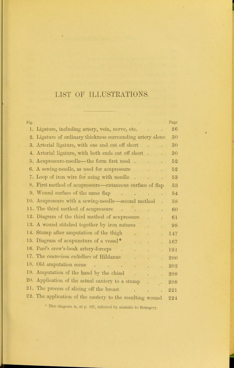 LIST OF ILLUSTRATIONS. Fig. - Page 1. Ligatiu-e, inchiding artery, vein, nerve, etc. . . 26 2. Ligature of ordinary tliickness surrounding artery alone 30 3. Ai-terial ligature, with one end cut ofl' short . . 30 4. Ai'terial ligature, with both endts cut off short . . 30 5. Acupressure-needle—the form first used . . .52 6. A sewing-needle, as used for acupressure . . 52 7. Loop of iron wire for using with needle . . .53 8. First method of acupressure—cutaneous siu'face of flap 53 9. Wound surface of the same flap . . . .54 10. Acupressure with a sewing-needle—second method . 58 11. The third method of acuj)ressure .... 60 12. Diagram of the tliird method of acupressure . . 61 13. A wound stitched together by iron sutures . . 98 14. Stump after amputation of the thigh . . .147 15. Diagram of acupuncture of a vessel* . . .167 16. Fare's crow's-beak aiiery-forceps . . . .191 17. The cautenum cultellare of Hildanus . . . 200 18. Old amputation scene , . . . . .202 19. Amputation of the hand by the chisel . . . 208 20. Application of the actual cautery to a stump . . 208 21. Tlie process of slicing ofl the breast . . .221 22. Tlie application of the cautery to the residting wound 224 « This diagram is, at p. 167, referred liy mistake to Bourgery.