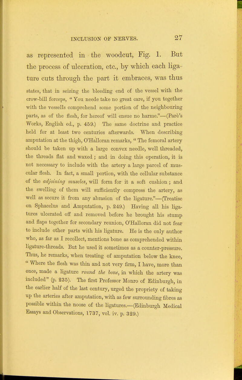 as represented in the woodcut, Fig. 1. But tlie process of ulceration, etc., by which each liga- ture cuts through the part it embraces, was thus states, that in seizing the bleeding end of the vessel with the crow-bill forceps,  You neede take no great care, if you together with the vessells comprehend some portion of the neighbouring parts, as of the flesh, for hereof will ensue no harme.—(Park's Works, English ed., p. 459.) The same doctrine and practice held for at least two centimes afterwards. When describing amputation at the thigh, O'Halloran remarks,  The femoral arteiy should be taken up with a large convex needle, well threaded, the threads flat and waxed ; and in doing this operation, it is not necessary to include with the artery a large parcel of mus- cular flesh. In fact, a small portion, with the cellular substance of the adjoining muscles, will form for it a soft cushion ; and the swelling of them will sufiiciently compress the artery, as well as secure it from any abrasion of the ligature.—(Treatise on Sphacelus and Amputation, p. 249.) Having all his Kga- tures ulcerated off and removed before he brought his stump and flaps together for secondary reunion, O'Halloran did not fear to include other parts with his ligature. He is the only author who, as far as I recollect, mentions bone as comprehended within ligature-threads. But he used it sometimes as a counter-pressure. Thus, he remarks, when treating of amputation below the knee,  Where the flesh was thin and not very firm, I have, more than once, made a ligature round the hone, in which the artery was included (p. 235). The first Professor Monro of Edinburgh, in the earlier haK of the last century, urged the propriety of taking up the arteries after amputation, with as few surrounding fibres as possible within the noose of the Hgatures.—(Edinburgh Medical Essays and Observations, 1737, vol. iv. p. 329.)