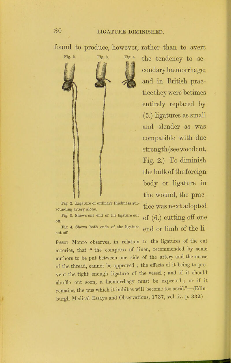 found to produce, however, rather than to avert Fig. 3. Pig. 4. ^Yie tendency to se- condary heemorrhage; and in British prac- tice they were betimes entirely replaced by (5.) ligatures as small and slender as was compatible with due strength (see woodcut. Fig. 2.) To diminish the bulk of the foreign body or ligature in the wound, the prac- tice was next adopted Fig. 3. Shews one end of theligatnre cut ^£ cuttiug off OUC Pig. 2. Ligature of ordinary thickness sur rounding artery alone. off. Fig. 4. Shews both ends of the ligature Jimb of thc 11- cut off. fessor Monro observes, in relation to the ligatures of the cut arteries, that  the compress of liiien, recommended by some authors to be put between one side of the artery and the noose of the thread, cannot be approved ; the effects of it being to pre- vent the tight enough ligature of the vessel ; and if it should shuffle out soon, a hfemorrhagy must be expected ; or if it remains, the pus which it imbibes wUl become too acrid.—(Edin- burgh Medical Essays and Observations, 1737, vol. iv. p. 332.)