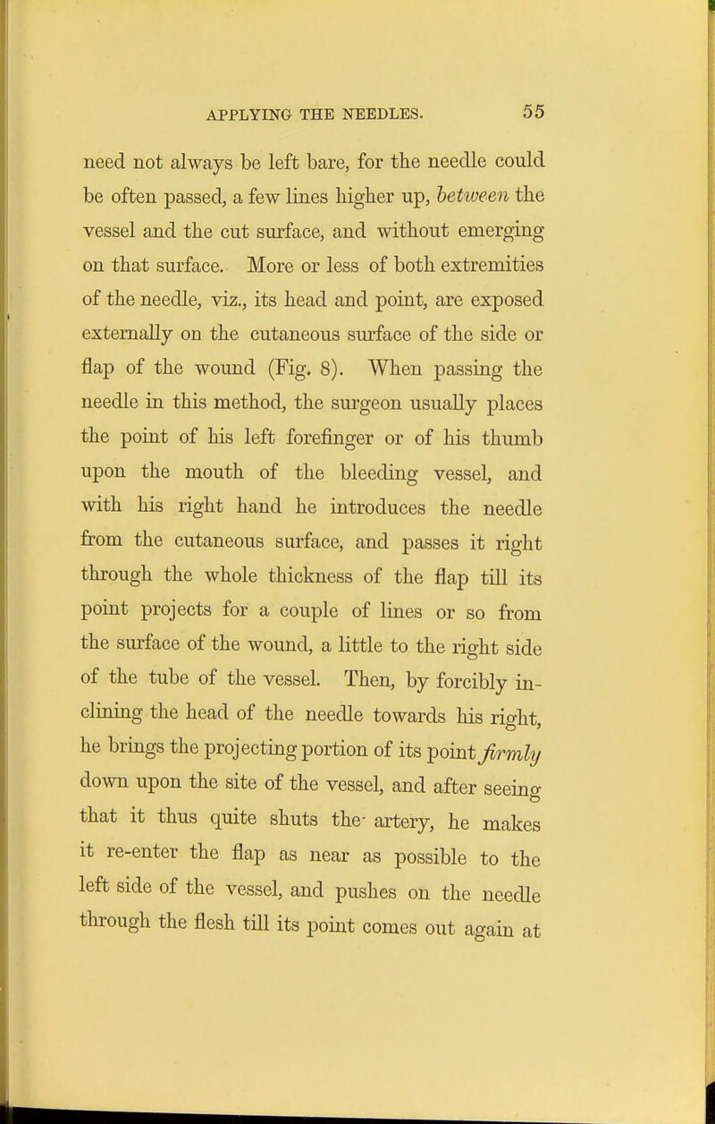 need not always be left bare, for the needle could be often passed, a few lines higher up, between the vessel and the cut surface, and without emerging on that surface. More or less of both extremities of the needle, viz., its head and point, are exposed externally on the cutaneous surface of the side or flap of the wound (Fig. 8). When passing the needle in this method, the surgeon usually places the point of his left forefinger or of his thumb upon the mouth of the bleeding vessel, and with his right hand he introduces the needle from the cutaneous surface, and passes it right through the whole thickness of the flap till its point projects for a couple of lines or so from the surface of the wound, a little to the right side of the tube of the vessel. Then, by forcibly in- clining the head of the needle towards his right, he brings the projecting portion of its ^ointjirmhj down upon the site of the vessel, and after seeino- that it thus quite shuts the- artery, he makes it re-enter the flap as near as possible to the left side of the vessel, and pushes on the needle through the flesh tHl its point comes out again at