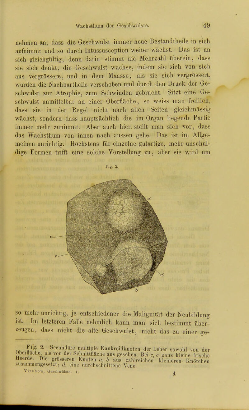 nehmen an, dass die Geschwulst immer neue Bestandtheile in sich aufnimmt und so durch Intussusception weiter wächst. Das ist an sich gleichgültig; denn darin stimmt die Mehrzahl überein, dass sie sich denkt, die Geschwulst wachse, indem sie sich von sich aus vergrössere, und in dem Maasse, als sie sich vergrössert, würden die Nachbartheile verschoben und durch den Druck der Ge- schwulst zur Atrophie, zum Schwinden gebracht. Sitzt eine Ge- schwulst unmittelbar an einer Oberfläche, so weiss man freilich, dass sie in der Regel nicht nach allen Seiten gleichmässig wächst, sondern dass hauptsächlich die im Organ liegende Partie immer mehr zunimmt. Aber auch hier, stellt man sich vor, dass das Wachsthum von innen nach aussen gehe. Das ist im Allge- meinen unrichtig. Höchstens für einzelne gutartige, mehr unschul- dige Formen triift eine solche Vorstellung zu, aber sie wird um Fig. 2. so mehr unrichtig, je entschiedener die Malignität der Neubildung ist. Im letzteren Falle nehmlich kann mau sich bestimmt über- zeugen, dass nicht die alte Geschwulst, nicht das zu einer ge- rn ^' , Secundäre multiple Kaukroidkuoten der Leber sowohl von der überflache als von der Schnittfläche aus gesehen. Bei c, c ganz kleine frische ueerde. üie grösseren Knoten a, b aus zahlreichen kleineren Knötchen zusammengesetzt; d. eine durchschnittene Vene. Virchow, Geschwülste. 1. a