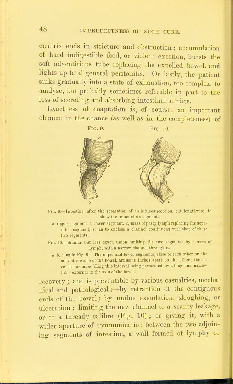 IMPEEFECTNESS OF SUCH CUllE. cicatiLx ends in stricture and obstruction; accumulation of hard indigestible food, or violent exertion, bursts the soft adventitious tube replacing the expelled bowel, and lights up fatal general peritonitis. Or lastly, the patient sinks gradually into a state of exhaustion, too complex to analyse, but probably sometimes referable in part to the loss of secreting and absorbing intestinal surface. Exactness of coaptation is, of course, an important element in the chance (as well as in the completeness) of Fig. 9. Fig. ]0. Fig. 9.—Intestine, after the separation of an intus-susception, cut lengthwise, to sliow tlie union of its segments. a, upper segment, i, lower segment, c, mass of pasty lymph replacing the sepa- rated segment, so as to enclose a channel continuous with that of these two segments. Fig. 10.—Similar, hut less cxnct, union, uniting the two segments by a mass of lymph, with a narrow channel through it. a, b, c, as in Fig. 9. The upper and lower segments, close to each other on the mesenteric side of the bowel, are some inches apart on the other; the ad- ventitious mass filling this interval being permeated by a long and narrow tube, external to the axis of the bowel. recovery ; and is preventible by various casualties, mecha- nical and pathological:—by retraction of the contiguous ends of the bowel; by undue exsudation, slougliing, or ulceration ; limiting the new channel to a scanty leakage, or to a thready calibre (Fig. 10) ; or giving it, with a wider aperture of communication between the two adjoin- ing segments of intestine, a wall formed of l)™phy or