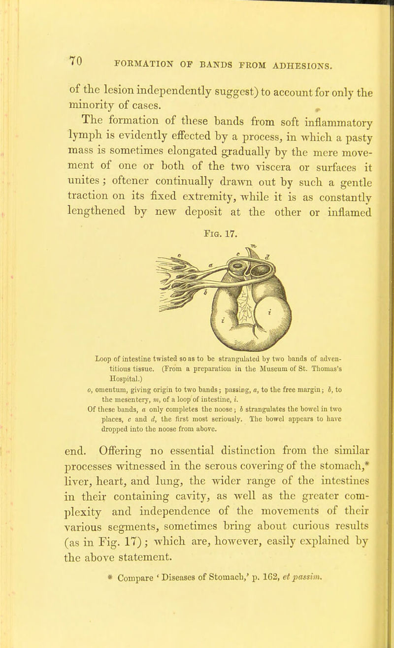 FORMATION OF BANDS FROM ADHESIONS. of the lesion independently suggest) to account for only the minority of cases. ^ The formation of these hands from soft inflammatory lymijh is evidently effected hy a process, in which a pasty mass is sometimes elongated gradually by the mere move- ment of one or both of the two viscera or surfaces it unites; oftener continually dra-\vn out by such a gentle traction on its fixed extremity, while it is as constantly lengthened by new deposit at the other or inflamed Fig. 17. Loop of intestine twisted so as to be strangulated by two bands of adven- titious tissue. (From a preparatiou in the Museum of St. Thomas's Hospital.) 0, omentum, giving origin to two bands; passing, a, to the free margin; i, to the mesentery, m, of a loop of intestine, i. Of these bands, a only completes the noose; h strangulates the bowel in two places, c and d, the first most seriously. The bowel appears to have dropped into the noose from above. end. Offering no essential distinction from the similar processes witnessed in the serous covering of the stomach,* liver, heart, and lung, the wider range of the intestines in their containing cavity, as well as the greater com- plexity and independence of the movements of their various segments, sometimes bring about curious results (as in Fig. IT); which are, however, easily explained by the above statement. * Compare ' Diseases of Stomacb,' p. 162, et passim.