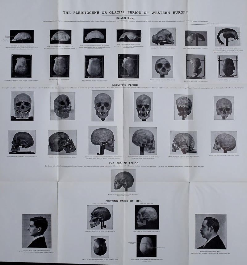 THE PLEISTOCENE OR GLACIAL PERIOD OF WESTERN EUROPE. PAL/EOLITHIC. Tlio tcim PttlD301ithio is uplojud ta iliatinguiah formationa whioh coittaiu the rudest shapes of human stone implements assooiated with the tomoins ol maramula, 8< e o[ which are extinct, find others have disappeitred (rem distriota wh^re thoir 5 have been found. I.ATKil SIDE VJBW OP THE JAVA SKULI^OAr. Showinii thn npr-Ilkc vrujcctloii of bone HboT>< the nrhit-. Cm SIPK VIKW OF Tin-: srv I No. 1, SKULI^OAP. WKh pmmlnPnl riilgoi, A, a^. i. „rl)lt«, iiniJ rrenllni,- lanli«a<l, B. SIDK VIEV OP TltK SI.TOO SKiri,L-CAP. SIDK VIEW OF TlIK NKANDKUTIIAL BKULI.OAP. Ar^llko r™n.iiicno(. A. .OmTe orblte; rcc«llnj( forclicod. B ; SbowIUf. prominent rlclBea nbovi^ tlio n^h^t^ rccMlin« torvliend, am absence of BUtures. SIDE VIKW Ol- THK i JAVA SKUI.I^ AS I'HUM AHUVI:. iXornm lenicalti.) Diiritig this period there wns a. gradual but dislinct improvement in the norkmtinship of tht stone impleiuenta used by n KEANDEItTHAL SKULL. {.Vorma trrtiailii.) NEOLITf ,3 still ignorant of the use of nietiils. Mi\ny of liis stone Wfapuii: IC PERIOD. ■ere highly polished and beautifully formed. Thefiiunaaud flora were the S1I11-; VIKW OF THK TLI.IH UV .^KI'l.l^CAf. romirrenre over ^yrtjron-e still marked, A, Iiul tlw lonhcod more ilvVL'lapcO, B, anil ioiUcutluiis at tutlircs to tw icvii. LHUltV KKUI.L. i.V^i:mi rfrUialli.) sanis as those still existing in Western Europe, with few exceptionp, auch as the Iriah elk, reindeer, beaver, and grizzly bear. r PnONT AND SIDE VIEW OF A WltaMAGKON SKULU MDE VIKW UK MSSTOXK SKULU I FRONT AND BiDK VIKW OF ONR OF THE SKULLS FLIUN THE nODMAllTOS DOLMB.N, EAIILY NKOI.i'JHir I'Kiiin niONT AND SIDK YIFWS OF LOSf; BAIIROW SKULL FIU>M CiATCOMBii, (ILOUOESTEltSHIRfL FHUKT AND SIDE VIEWS OF KYUPSFIELD I3KULL. THE BRONZE PERIOD. The Bronze followed the Neolithic epoch in Western Europe ; it is charaeterised by the gradual aubstilution of Bronze instruinsntfi and weapons for those of alone, bone, and horn. The use of iron among the inhabitants of Europe waa of a much later dale. SKULL OF NATIVE OP AUSTRALIA OF THE PRESENT TIUB. SKULL OP AN BSOLISBSIAS OP THE PRESENT TlilB. (Jfcrnin miicaHi.) | (jVomu ttiHtaHi.)