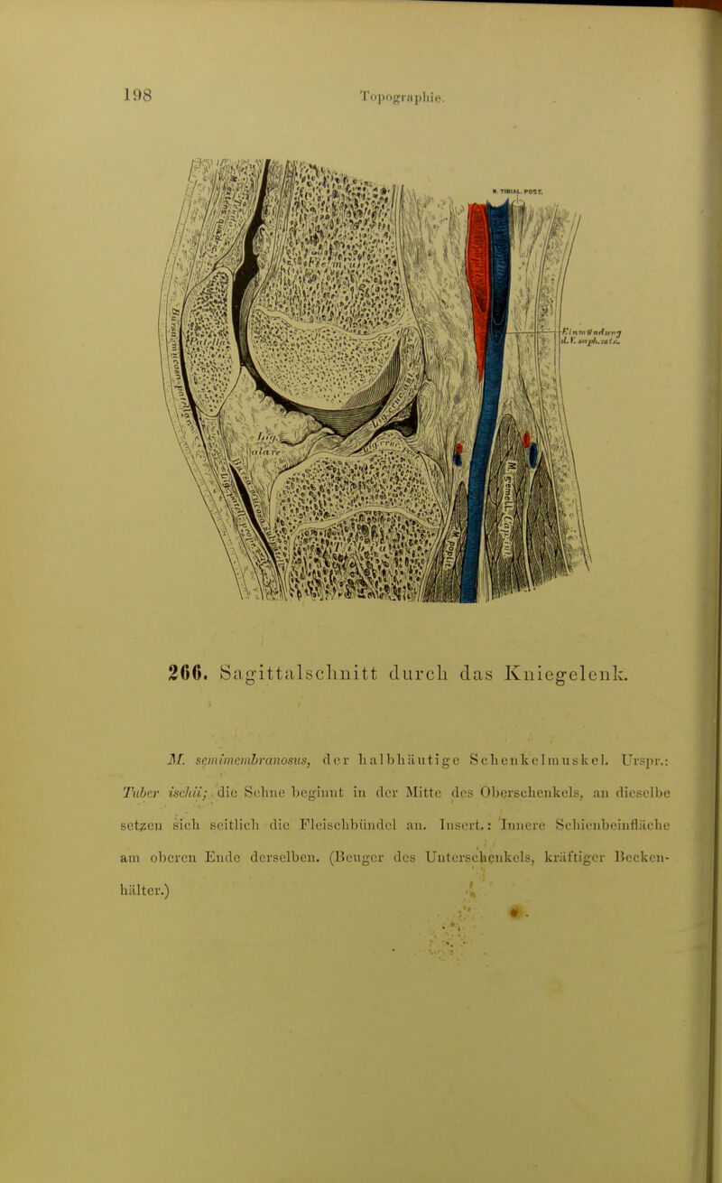 266. Sag'ittalsclmitt durch das Knieg-elenk. M. semimemhranosus, eleu- Ii albliäutige Scheiikclmuskel. Urspr.: Tuber isddi; die Sehne beginnt in der Mitte des Obcrsubcnkels, an dicsellie sotten sieh s(!itbeli die ricischbündel an. Tnsert,: Innere Schionbeinfläche am oberen Ende derselben. (Beuger des Unterschenkels, kräftiger Bcckon- hälter.)