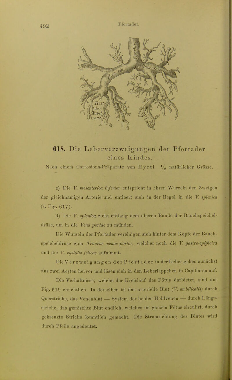 J'foit.ader. 618. Die Leberverzweigungen der Pfortader eines Kindes. Nach eiucm CoiTOsions-Priiparate von llyrtl. '/^ natürlicher Grösse. c) Die V. mcscnterica inferior entsjiricht in ihren Wurzehi den Zweigen der gleichnamigen Arterie und entleert sich in der Hegel in die V. sphnka (s. Fig. 617). d) Die V. splenica zieht entlang dem oberen Rande der Bauchsijeichcl- drüse, um in die Vena poi'tae zu münden. Die Wurzeln der Pfortader vereinigen sich hinter dem Kopfe der Bauch- speicheldrüse zum Tnincus venae portac, welcher noch die F. gasiro-cpiploica und die V. cystidis fdleae. aufnimmt. Die Verzweigungen d e r P f o r t a d e r in der Leber gehen zunächst aus zwei Aegtcn hervor und lösen sich in den Leberliippchen in Capillareu auf. Die Verhältnisse, welche der Kreislauf des Fötus darbietet, sind aus Fig. 619 ersichtlich. In derselben ist das arterielle Blut (V. umbilicalis) durch Querstriche, das Venenblut — System der beiden Hohlvenen — durch Längs- striche, das gemischte Blut endlich, welches im ganzen Fötus circulirt, durch gekreuzte Striche kenntlich gemacht. Die Stromrichtung des Blutes wird durch Pfeile angedeutet.