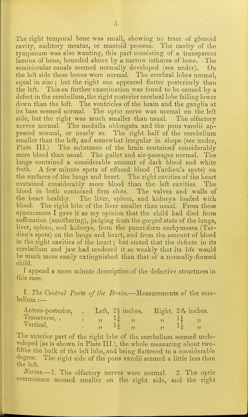 The right temporal bone was small, sliowing no trace of glenoid cavity, auditory meatus, or mastoid process. The cavity of the tympanum was also wanting, this part consisting of a transparent lamina of bone, bounded above by a narrow isthmus of bone. The semicircular canals seemed normally developed (see under). On the left side these bones were normal. The cerebral lobes normal, equal in size ; but the right one appeared flatter posteriorly than the left. This on further examination was found to be caused by a defect in the cerebellum, the right posterior cerebral lobe falling lower down than the left. The ventricles of the brain and the ganglia at its base seemed normal. The optic nerve was normal on the left side, but the right was much smaller than usual. The olfactory nerves normal. The medulla oblongata and the pons varolii ap- peared normal, or nearly so. The right half of the cerebellum smaller than the left, and somewhat irregular in shape (see under, Plate III.) The substance of the brain contained considerably more blood than usual. The gullet and air-passages normal. The lungs contained a considerable amount of dark blood and white froth. A few minute spots of effused blood (Tardieu's spots) on the surfaces of the lungs and heart. The right cavities of the heart contained considerably more blood than the left cavities. The blood in both contained firm clots. The valves and walls of the heart liealthy. The liver, spleen, and kidneys loaded with blood. The right lobe of the liver smaller than usual. From these appearances I gave it as my opinion that the cliild had died from suffocation (smothering), judging from the gorged state of the lungs, liver, spleen, and kidneys, from the punctiform ecchymoses (Tai- dieu's spots) on the lungs and heart, and from the amount of blood in the right cavities of the heart; but stated that the defects in its cerebellum and jaw had rendered it so weakly that its life would be much more easily extinguished than that of a normally-formed cliild. I append a more minute description of the defective structures in this case. I. Tlie Central Parts of the Brain.—Measurements of the cere- bellum :— Antero-posterior, . Left, 2f inches. Right, 2tV inches. Transverse,. . „ If „ „ 1^ „ Vertical, . . „ li „ „ 1^ „ The anterior part of the right lobe of the cerebellum seemed unde- veloped (as is shown in Plate III), the whole measuring about two- fifths the bulk of the left lobe, and being flattened to a considerable degree. The right side of the' pons varolii seemed a little less than tlie left. Nerves.—1. The olfactory nerves were normal. 2. The optic commissure seemed smaller on the right side, and the right