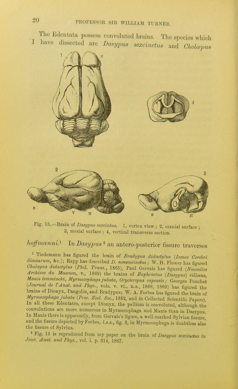 The Edentata possess convoluted brains. The species which I have dissected are Dasypua sexcinctus and Cholcepua Fig. 13.—Brain of Dasypus sexcintus. 1, vertex view; 2, cranial surface ; 3, mesial surface ; 4, vertical transverse section. hoffmanni} In Dasypus ^ an antero-posterior fissure traverses 1 Tiedemanu has figured the brain of Bradypus didadylus (Icmcs Cerebri Simmrum, &c.); Rapp has described D. novemcinctus; W. H. Flower has floured Cholospus didadylus {Phil, Trans., 1865), Paul Gervais has figured {Nouvelles Archives dio 3htseum, r., 1869) the brains of Euphractus {Dasypus) villosus, Manis temmiiwld, Myrmecophaga jubata, Orycteropus capensis; Georges Pouchet {Journal de VAnat. and Phys., vols. v. vi., n.s., 1868, 1869) has figured the brains of Diouyx, Pangolin, and Bradypus; W. A. Forbes has figured the brain of Myrmecoplmga jit.bata {Proc. Zool. Soc, 1882, and in Collected Scientific Papers) In all these Edentates, except Dionyx, the pallium is convoluted, although the convolutions are more numerous in Myrmecophaga and Manis than in Dasypus In Manis there is apparently, from Gervais's figure, a well-marked Sylvian fissure and the fissure depicted by Forbes, l.s.s., fig. 3, in Myrmecophaga is doubtless also the fissure of Sylvius. = Fig. 13 is reproduced from my paper on the brain ot Dasypus scaxinctus in Jour. Anat. and Phys., vol. i. p. 314, 1867.