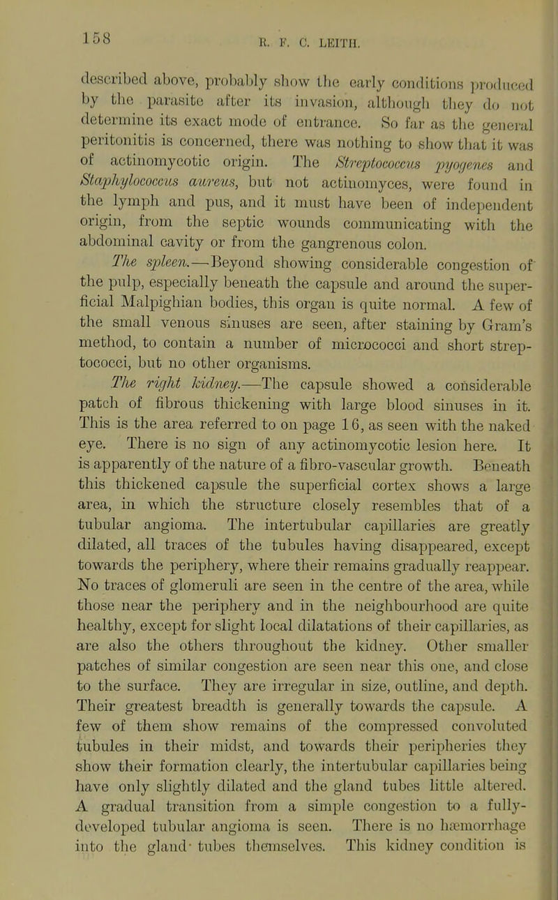 described above, probal)ly show the early conditions ))r()(hK',e(l by the parasite after its invasion, altliongli tliey do not determine its exact mode of entrance. So far as the general peritonitis is concerned, there was nothing to show that it was of actinomycotic origin. The Streptococcus pyogenes and Staphylococcus aureus, but not actiuomyces, were found in the lymph and pus, and it must have been of independent origin, from the septic w^ounds communicating with the abdominal cavity or from the gangrenous colon. The spleen.—Beyond showing considerable congestion of the pulp, especially beneath the capsule and around the super- ficial Malpighian bodies, this organ is quite normal. A few of the small venous sinuses are seen, after staining by Gram's method, to contain a number of micrx)cocci and short strep- tococci, but no other organisms. The right kidney.—The capsule showed a considerable patch of fibrous thickening with large blood sinuses in it. This is the area referred to on page 16, as seen with the naked eye. There is no sign of any actinomycotic lesion here. It is apparently of the nature of a fibro-vascular growth. Beneath this thickened capsule the superficial cortex shows a large area, in which the structure closely resembles that of a tubular angioma. The intertubular capillaries are greatly dilated, all traces of the tubules having disappeared, except towards the periphery, where their remains gradually reappear. No traces of glomeruli are seen in the centre of the area, while those near the periphery and in the neighbourhood are quite healthy, except for slight local dilatations of their capillaries, as are also the others throughout the kidney. Other smaller patches of similar congestion are seen near this one, and close to the surface. They are irregular in size, outline, and depth. Their greatest breadth is generally towards the capsule. A few of them show remains of the compressed convoluted tubules in their midst, and towards their peripheries they show their formation clearly, the intertubular capillaries being have only slightly dilated and the gland tubes little altered. A gradual transition from a simple congestion to a fully- developed tubular angioma is seen. There is no haemorrhage into the gland- tubes thanselves. This kidney condition is