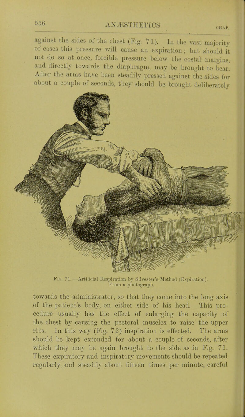(J HA?. against tlie sides of the cliest (Fig. 7l). In the vast majority of cases this pressure will cause an expiration ; but should it not do so at once, forcible pressure below the costal margins, and directly towards the diaphragm, may be brought to bear.' Al'tor the arms have been steadily pressed against the sides for about a couple of seconds, they should be brought deliberately F[G. 71.—Artili(^ical Respircation by Silvester's Method (Expiration). From a photograph. towards the administrator, so that they come into the long axis of the patient's body, on either side of his head. This pro- cedure usually has the effect of eularging the capacity of the chest by causing the pectoral muscles to raise the upper ribs. In this way (Fig. 72) inspiration is effected. The arms should be kept extended for about a couple of seconds, after which they may be again brought to the side as in Fig. 71. These expiratory and inspiratory movements should be repeated regularly and steadily about fifteen times per minute, careful