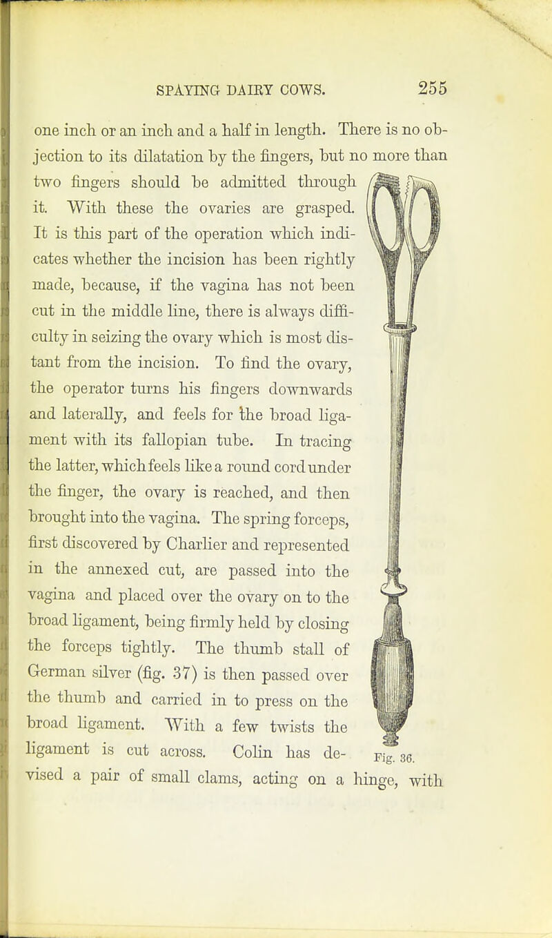 one inch or an incli and a half in length. There is no ob- jection to its dilatation by the fingers, but no more than two fijigers should be admitted through it. With these the ovaries are grasped. It is this part of the operation which indi- cates whether the incision has been rightly made, because, if the vagina has not been cut in the middle hne, there is always diffi- culty in seizing the ovary which is most dis- tant from the incision. To find the ovary, the operator turns his fingers downwards and laterally, and feels for Ihe broad liga- ment with its fallopian tube. In tracing the latter, which feels Kkea round cord under the finger, the ovary is reached, and then brought into the vagina. The spring forceps, first discovered by CharHer and represented in the annexed cut, are passed into the vagina and placed over the ovary on to the broad ligament, being firmly held by closing the forceps tightly. The thumb stall of German silver (fig. 37) is then passed over the thumb and carried in to press on the broad ligament. With a few twists the ligament is cut across. Cohn has de- mg.ae. vised a pair of small clams, acting on a hinge, with