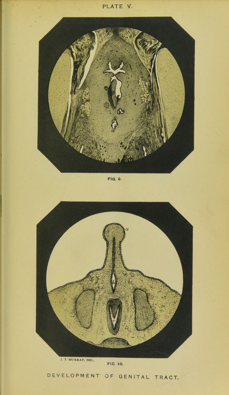 J T. MURRAY, DEL. FIO. 10.