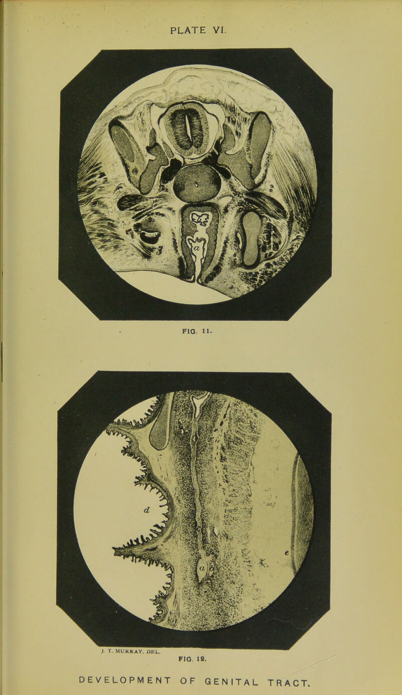 FIG. 11. FIQ. 18. I