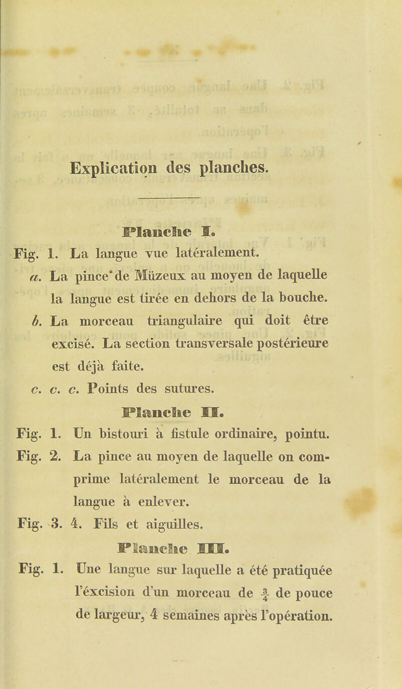 Explication des planches. ;^laiiclae I. Fig. 1. La langue vue lateralement. a. La pince'de Miizeux au moyen de laquelle la langue est iiree en dehors de la bouche. b. La morceau triangulaire qui doit etre excise. La section transversale posterieure est deja faite. c. c. c. Points des sutures. Planclie O. Fig. 1. Un bistouri a fistule ordinaire, pointu. Fig. 2. La pince au moyen de laquelle on corn- prime lateralement le morceau de la langue a enlever. Fig. 3. 4. Fils et aiguiUes. Plandie Ut. Fig. 1. Une langue sur laquelle a ete pratiquee I'excision d'un morceau de f de pouce de largeur, 4 semaines apres I'operation.