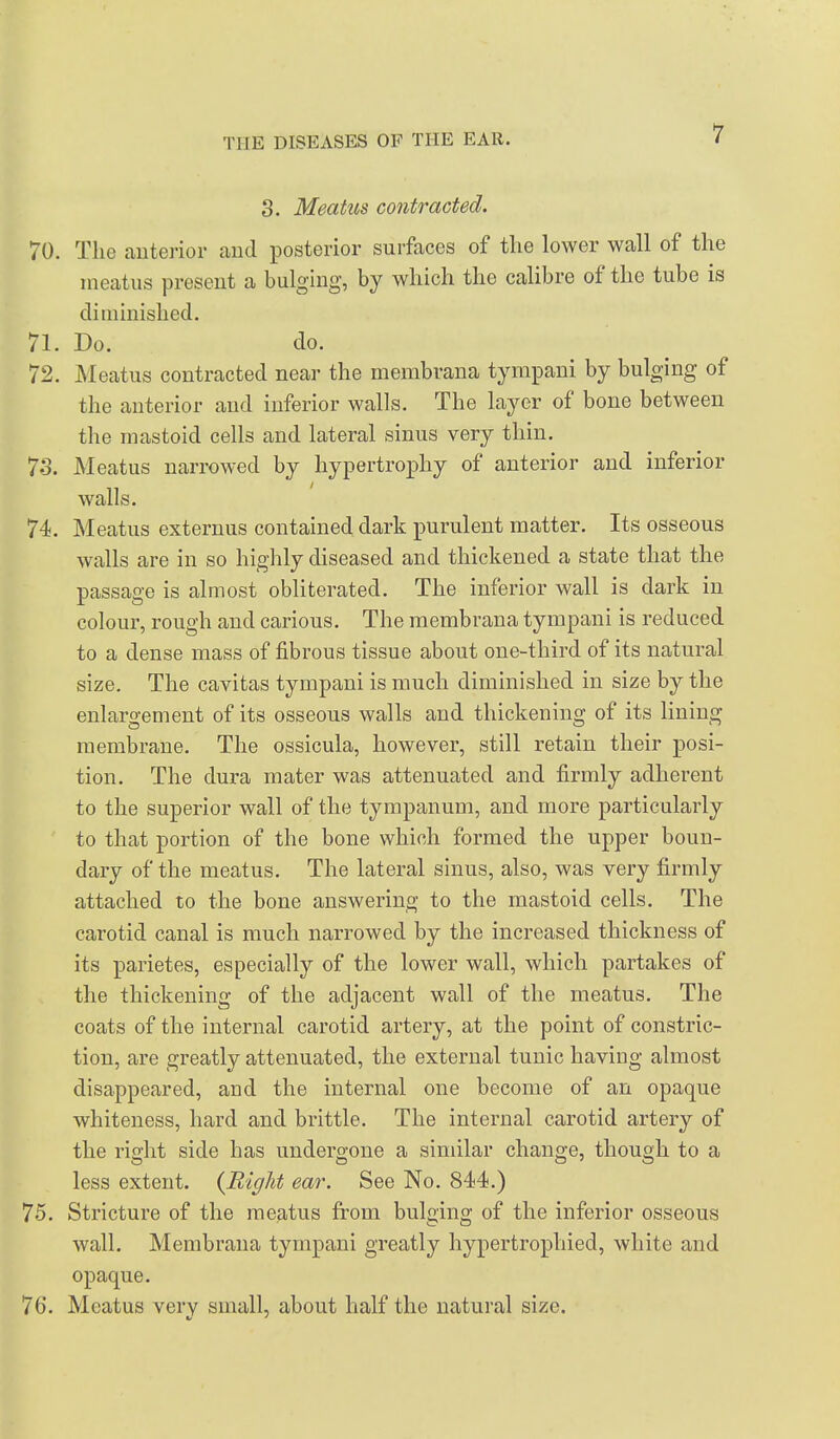 3. Meatus contracted. 70. The auterior aucl posterior surfaces of the lower wall of the meatus present a bulging, by which the calibre of the tube is diminished. 71. Do. do. 72. INIeatus contracted near the membrana tympaui by bulging of the auterior and inferior walls. The layer of bone between the mastoid cells and lateral sinus very thin. 73. Meatus narrowed by hypertrophy of anterior and inferior walls. 74. Meatus externus contained dark purulent matter. Its osseous walls are in so highly diseased and thickened a state that the passage is almost obliterated. The inferior wall is dark in colour, rough and carious. The membrana tympani is reduced to a dense mass of fibrous tissue about one-third of its natural size. The cavitas tympani is much diminished in size by the enlargement of its osseous walls and thickening of its lining membrane. The ossicula, however, still retain their posi- tion. The dura mater was attenuated and firmly adherent to the superior wall of the tympanum, and more particularly to that portion of the bone which formed the upper boun- dary of the meatus. The lateral sinus, also, was very firmly attached to the bone answering to the mastoid cells. The carotid canal is much narrowed by the increased thickness of its parietes, especially of the lower wall, which partakes of the thickening of the adjacent wall of the meatus. The coats of the internal carotid artery, at the point of constric- tion, are greatly attenuated, the external tunic having almost disappeared, and the internal one become of an opaque whiteness, hard and brittle. The internal carotid artery of the right side has undergone a similar change, though to a less extent. {Right ear. See No. 844.) 75. Stricture of the meatus from bulging of the inferior osseous wall. Membrana tympani greatly hypertrophied, white and opaque. 76. Meatus very small, about half the natural size.