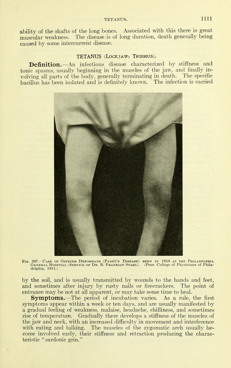 ability of the shafts of the long bones. Associated with this there is great muscular weakness. The disease is of long duration, death generally being caused by some intercurrent disease. Definition.—An infectious disease characterized by stiffness and tonic spasms, usually beginning in the muscles of the jaw, and finally in- volving all parts of the body, generally terminating in death. The specific bacillus has been isolated and is definitely known. The infection is carried Fig. 397.—Case of Osteiti8 Deformans (Paget's Disease) seen in 1910 at the Philadelphia General Hospital (Service of Dr. B. Franklin Stahl). (Proc. College of Physicians of Phila- delphia, 1911.) by the soil, and is usually transmitted by wounds to the hands and feet, and sometimes after injury by rusty nails or firecrackers. The point of entrance may be not at all apparent, or may take some time to heal. Sjrmptoms.—The period of incubation varies. As a rule, the first symptoms appear within a week or ten days, and are usually manifested by a gradual feeling of weakness, malaise, headache, chilliness, and sometimes rise of temperature. Gradually there develops a stiffness of the muscles of the jaw and neck, with an increased difficulty in movement and interference with eating and talking. The muscles of the zygomatic arch usually be- come involved early, their stiffness and retraction producing the charac- teristic sardonic grin. TETANUS (LOCKJAW; Trismus).