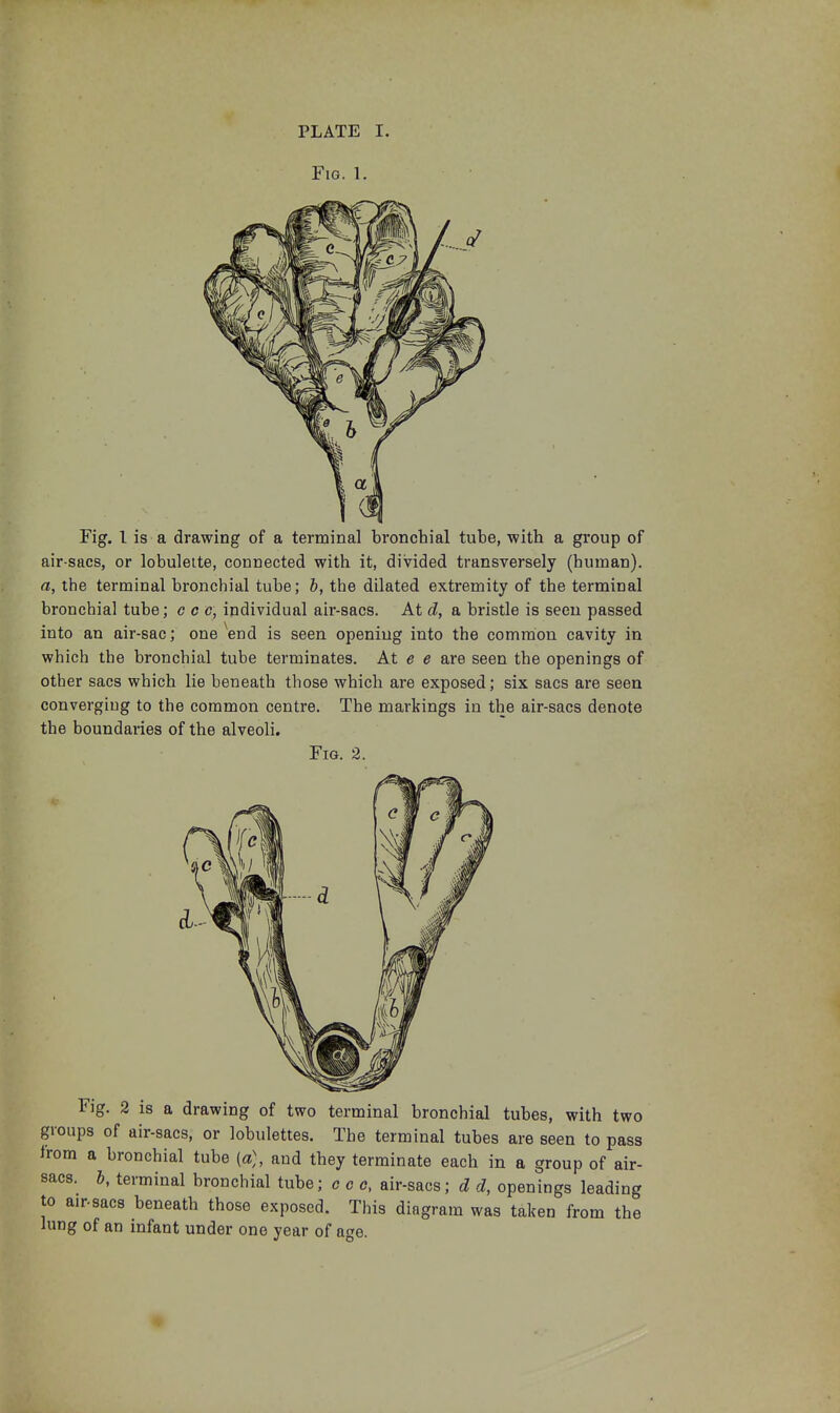 Fig. 1. Fig. I is a drawing of a terminal bronchial tube, with a group of air-sacs, or lobuleite, connected with it, divided transversely (human). a, the terminal bronchial tube; h, the dilated extremity of the terminal bronchial tube; c c c, individual air-sacs. At d, a bristle is seen passed into an air-sac; one end is seen opening into the common cavity in which the bronchial tube terminates. At e e are seen the openings of other sacs which lie beneath those which are exposed; six sacs are seen converging to the common centre. The markings in the air-sacs denote the boundaries of the alveoli. Fig. 2. Fig. 2 is a drawing of two terminal bronchial tubes, with two groups of air-sacs, or lobulettes. The terminal tubes are seen to pass Irom a bronchial tube (a), and they terminate each in a group of air- sacs, h, terminal bronchial tube; c c o, air-sacs; d d, openings leading to a.r.sac8 beneath those exposed. This diagram was taken from the lung of an infant under one year of age.