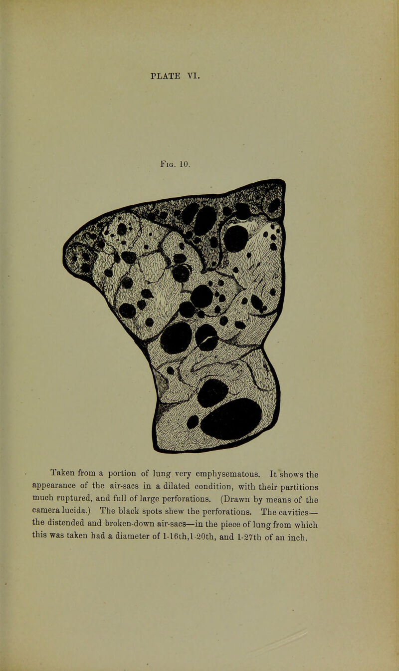 Fig. 10. Taken from a portion of lung very emphysematous. It shows the appearance of the air-sacs in a dilated condition, with their partitions much ruptured, and full of large perforations. (Drawn by means of the camera lucida.) The black spots shew the perforations. The cavities— the distended and broken-down air-sacs—in the piece of lung from which this was taken had a diameter of l-16ih,l-20th, and l-27th of an inch.