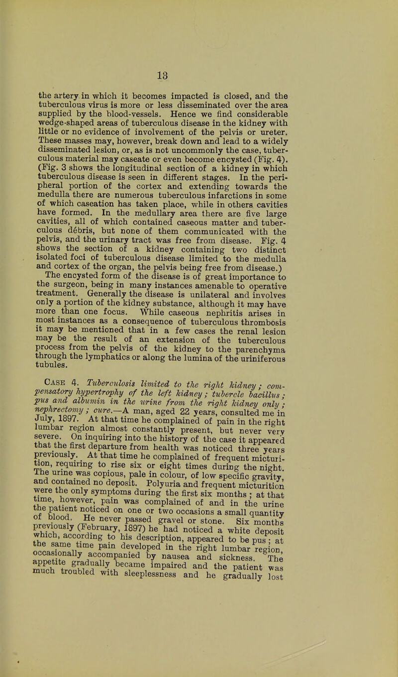 the axtery in which it becomes impacted is closed, and the tuberculous virus is more or less disseminated over the area supplied by the blood-vessels. Hence we find considerable wedge-shaped areas of tuberculous disease in the kidney with little or no evidence of involvement of the pelvis or ureter. These masses may, however, break down and lead to a widely disseminated lesion, or, as is not uncommonly the case, tuber- culous material may caseate or even become encysted (Fig. 4). (Fig. 3 shows the longitudinal section of a kidney in which tuberculous disease is seen in different stages. In the peri- pheral portion of the cortex and extending towards the medulla there are numerous tuberculous infarctions in some of which caseation has taken place, while in others cavities have formed. In the medullary area there are five large cavities, all of which contained caseous matter and tuber- culous d6bris, but none of them communicated with the pelvis, and the urinary tract was free from disease. Fig. 4 shows the section of a kidney containing two distinct isolated foci of tuberculous disease limited to the medulla and cortex of the organ, the pelvis being free from disease.) The encysted form of the disease is of great importance to the surgeon, being in many instances amenable to operative treatment. Generally the disease is unilateral and involves only a portion of the kidney substance, although it may have more than one focus. While caseous nephritis arises in most instances as a consequence of tuberculous thrombosis it may be mentioned that in a few cases the renal lesion may be the result of an extension of the tuberculous process from the pelvis of the kidney to the parenchyma through the lymphatics or along the lumina of the uriniferous tubules. Case 4. Tutermilosis limited to the right kidney; com- pensatory hypertrophy of the left kidney; tubercle bacillus • pus and albumin in the urine from the right kidney only '• nephrectomy; cure.—X man, aged 22 years, consulted me in Juljs 1897. At that time he complained of pain in the right lumbar region almost constantly present, but never very severe. On inquiring into the history of the case it appeared that the first departure from health was noticed three years previously. At that time he complained of frequent micturi- tion, requiring to rise six or eight times during the night The urine was copious, pale in colour, of low specific gra^ty* and contained no deposit. Polyuria and frequent micturition were the only symptoms during the first six months : at that tune, however, pain was complained of and in the urine tbe patient noticed on one or two occasions a small quantity ot blood. He never passed gravel or stone. Six months Eh t7 (^f.b^'^Yy. 1897) he had noticed a white deposit which, according to his description, appeared to be pus • at the same time pain developed in the right lumbar reg on Tntm^^ accompanied by nausea afd sickness ^The S f ^''^^f^l became impaired and the patient ias much troubled with sleeplessness and he gradually lott